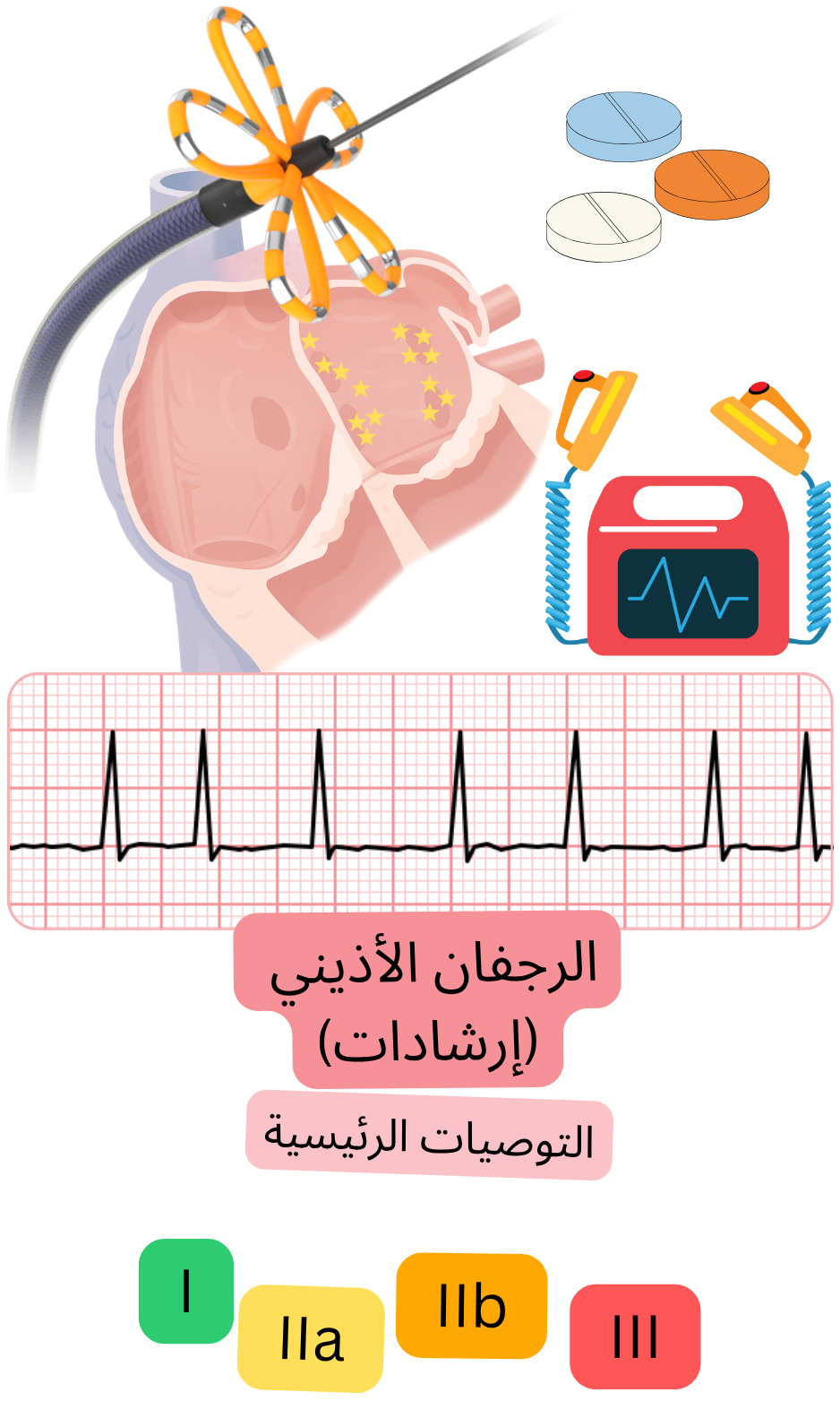 إنفوغراف طبي يوضح التوصيات السلوفاكية الأساسية للرجفان الأذيني بما في ذلك الكي بالقسطرة، العلاج المضاد للتخثر، مراقبة تخطيط القلب، وفئات التوصيات I وIIa وIIb وIII.