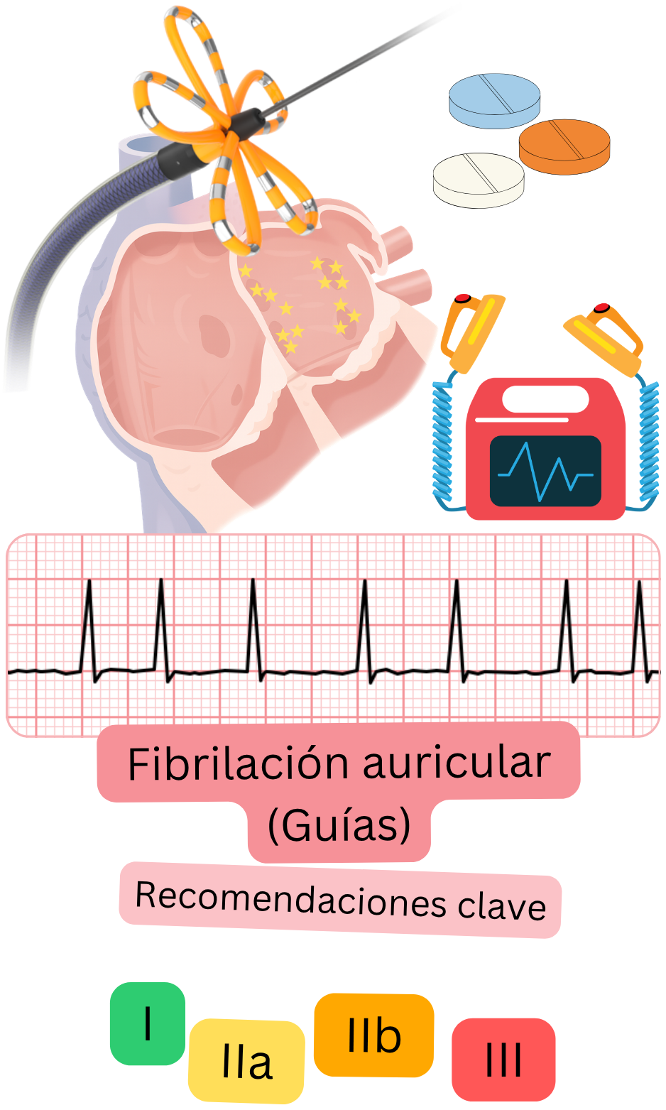 Infografía de las recomendaciones clave eslovacas sobre fibrilación auricular que muestra estrategias terapéuticas como ablación con catéter, tratamiento antitrombótico, monitorización ECG y clases I, IIa, IIb y III.