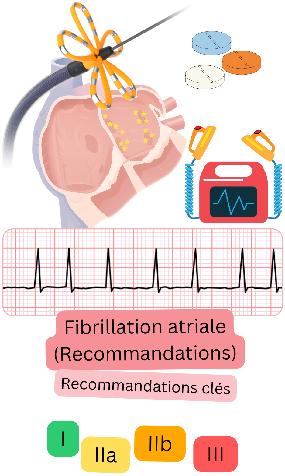 Infographie des recommandations slovaques clés sur la fibrillation auriculaire illustrant l’ablation par cathéter, le traitement antithrombotique, la surveillance ECG et les classes I, IIa, IIb et III.