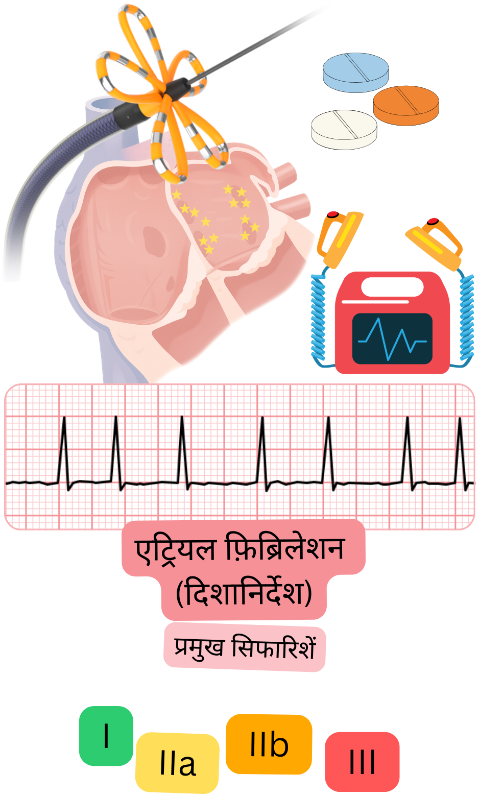 एट्रियल फ़िब्रिलेशन के लिए स्लोवाक प्रमुख क्लिनिकल सिफारिशों का इन्फोग्राफिक, जिसमें कैथेटर एब्लेशन, एंटीथ्रोम्बोटिक उपचार, ईसीजी मॉनिटरिंग और I, IIa, IIb, III वर्ग शामिल हैं।