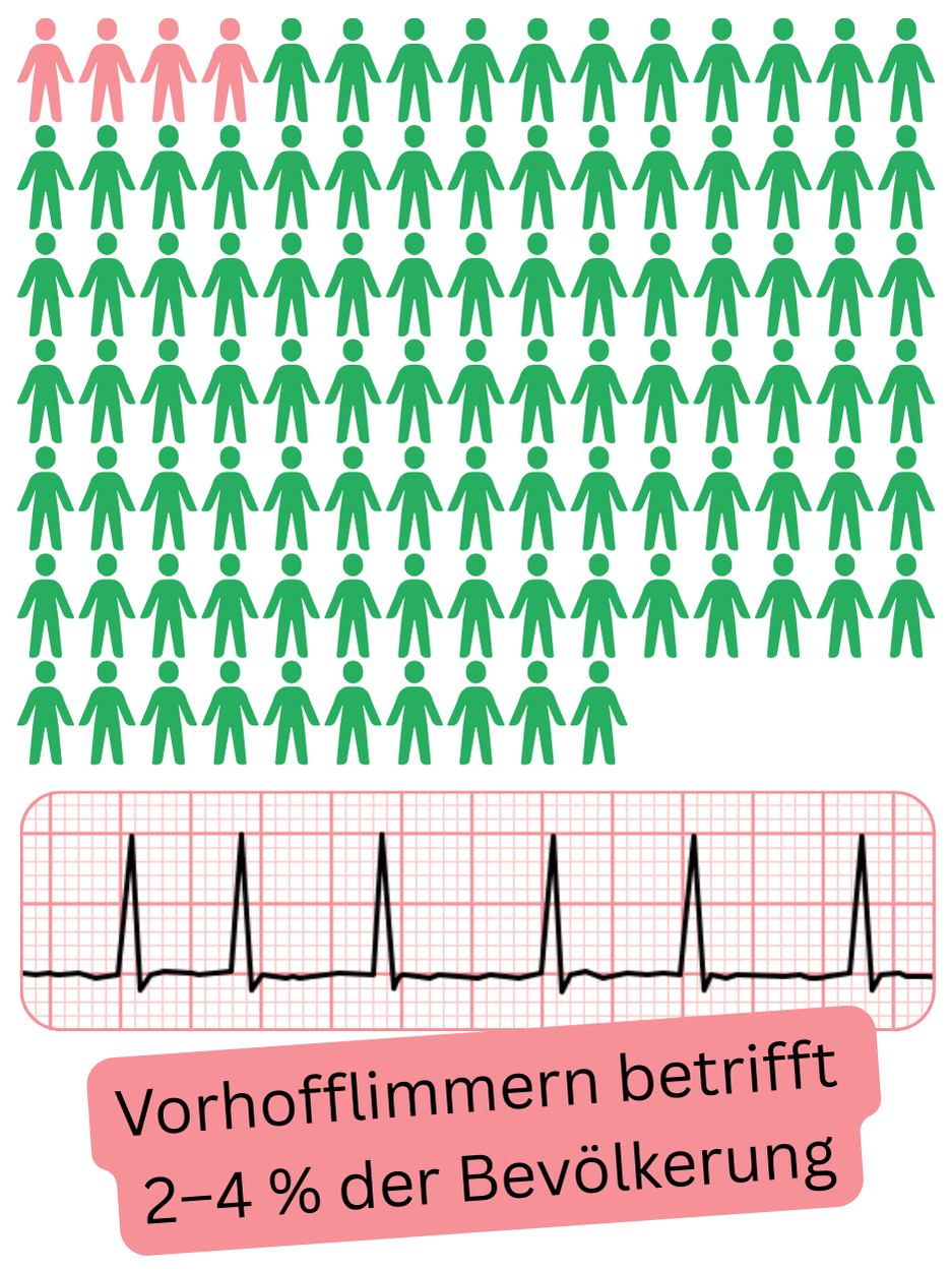 Infografik zur Darstellung der Prävalenz von Vorhofflimmern in der Allgemeinbevölkerung von etwa 2–4%.