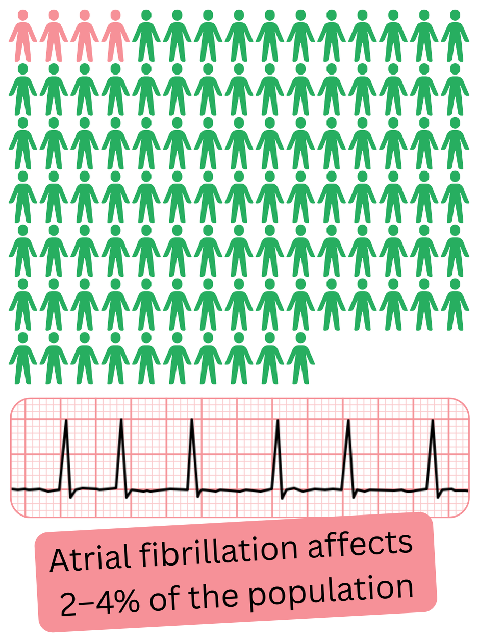 Infographic illustrating the prevalence of atrial fibrillation in the general population at approximately 2–4%.