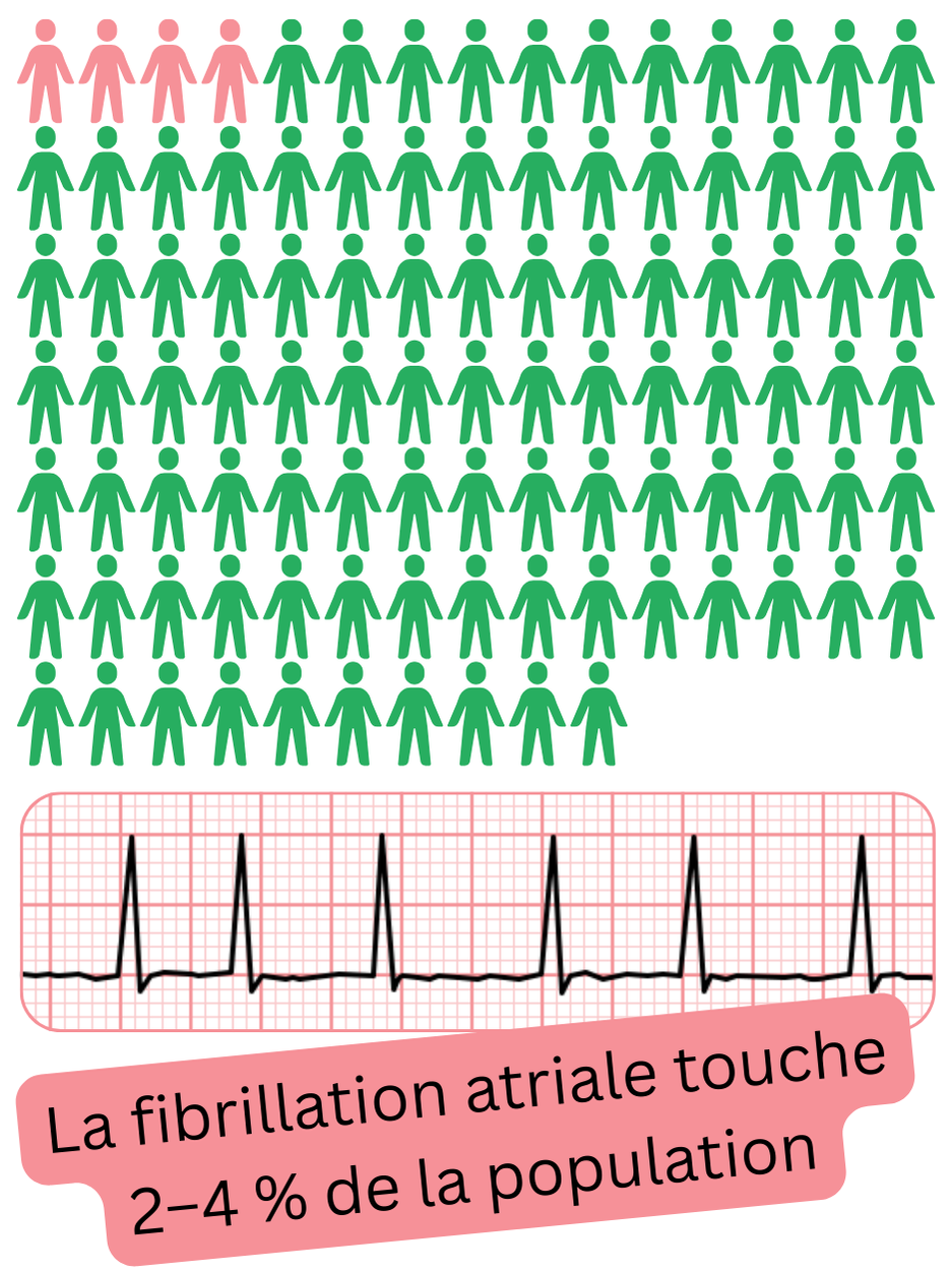 Infographie illustrant la prévalence de la fibrillation atriale dans la population générale, estimée à environ 2–4%.
