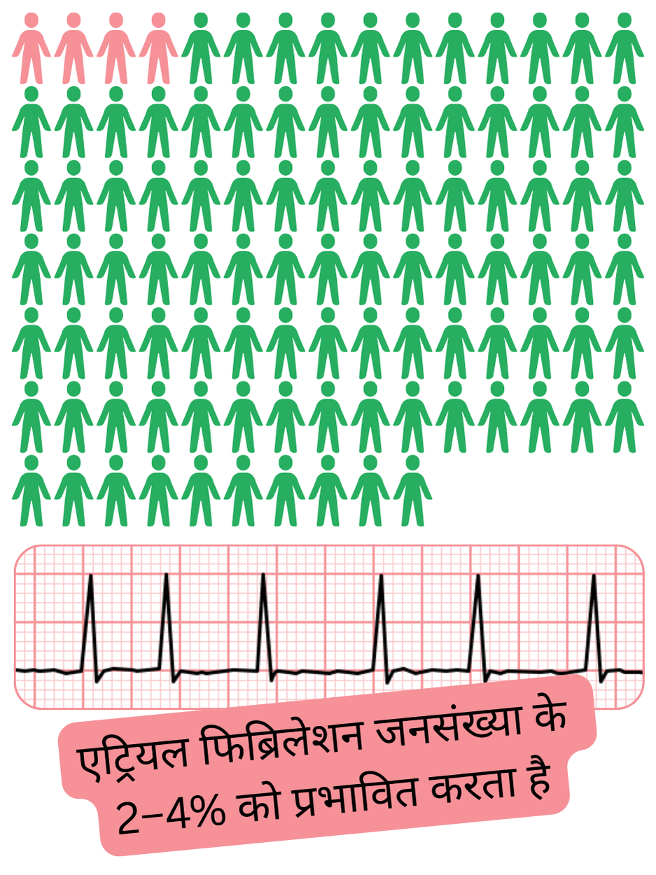 इन्फोग्राफिक जो सामान्य जनसंख्या में एट्रियल फिब्रिलेशन की व्यापकता लगभग 2–4% दर्शाता है।
