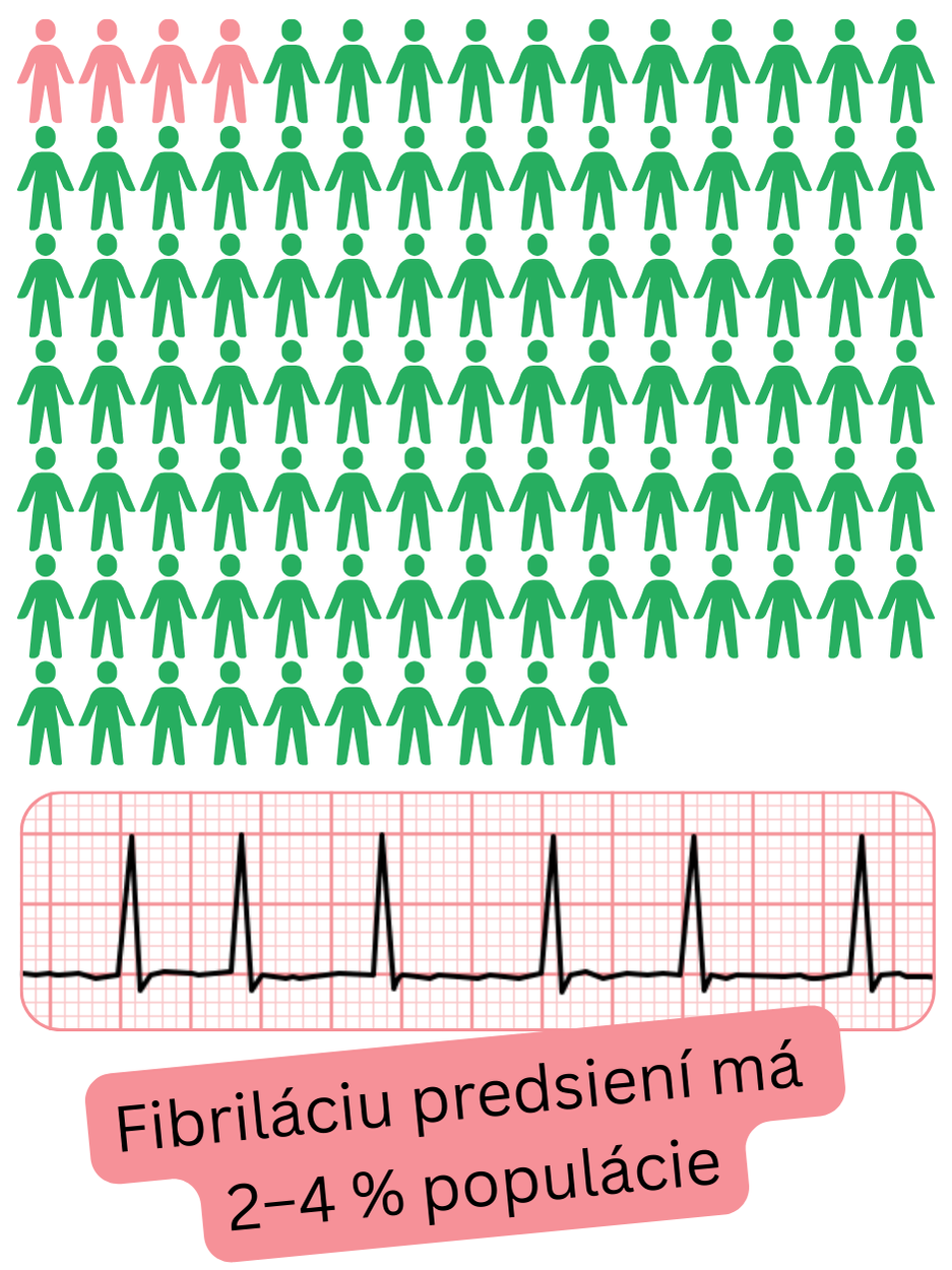 Infografika znázorňujúca prevalenciu fibrilácie predsiení v populácii na úrovni približne 2–4 %.
