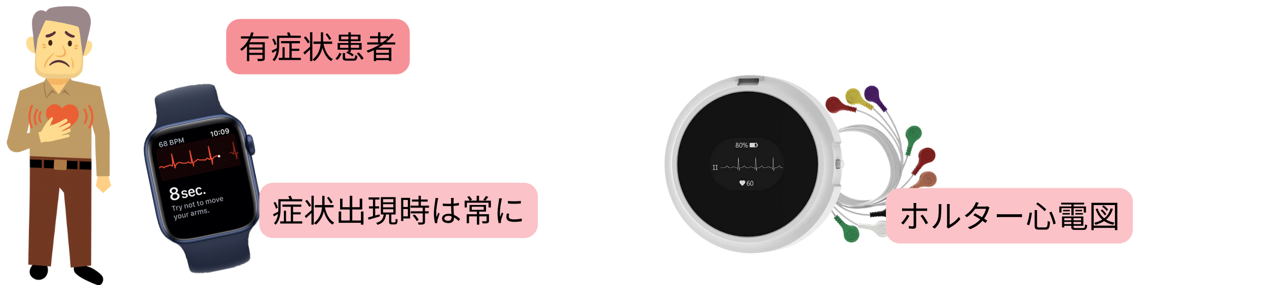 症状を有する患者において、症状出現時の心電図記録またはホルター心電図を用いた心房細動診断の模式図。