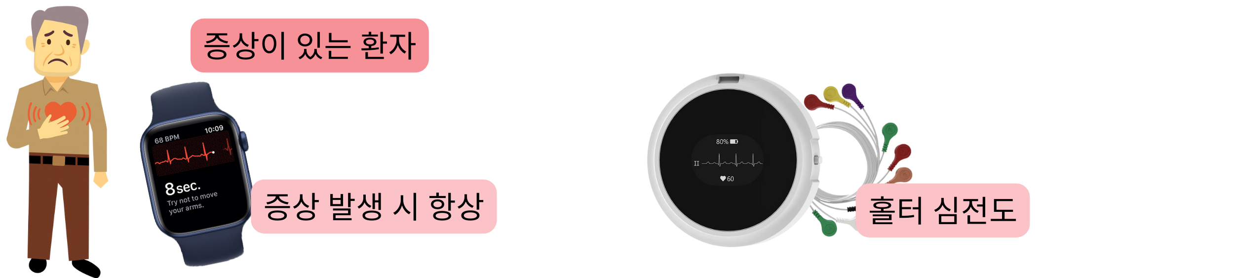 증상이 있는 환자에서 증상 발생 시 심전도 기록 또는 홀터 모니터링을 이용한 심방세동 진단 도식.