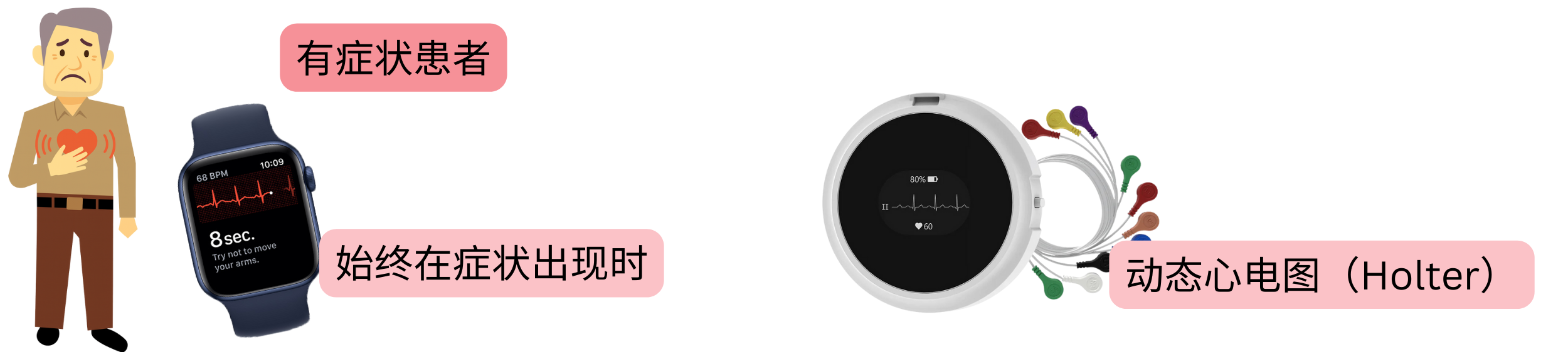 示意图展示对有症状患者通过症状发作时的心电图记录或Holter动态监测进行心房颤动诊断。