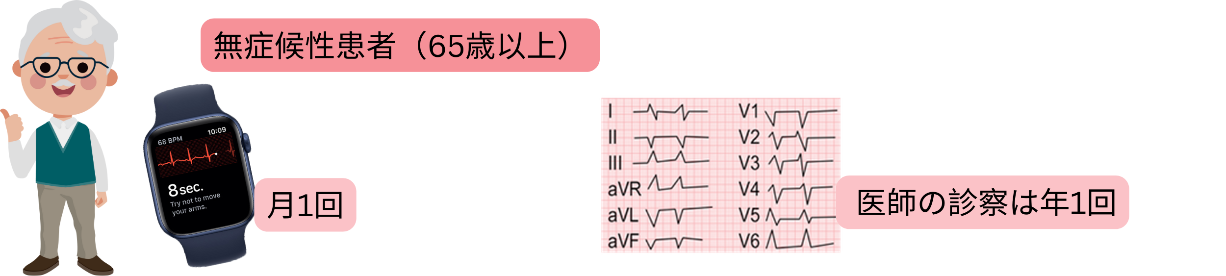 65歳以上の無症候性患者に対し、定期的な心電図モニタリングを用いて心房細動をスクリーニングする模式図。