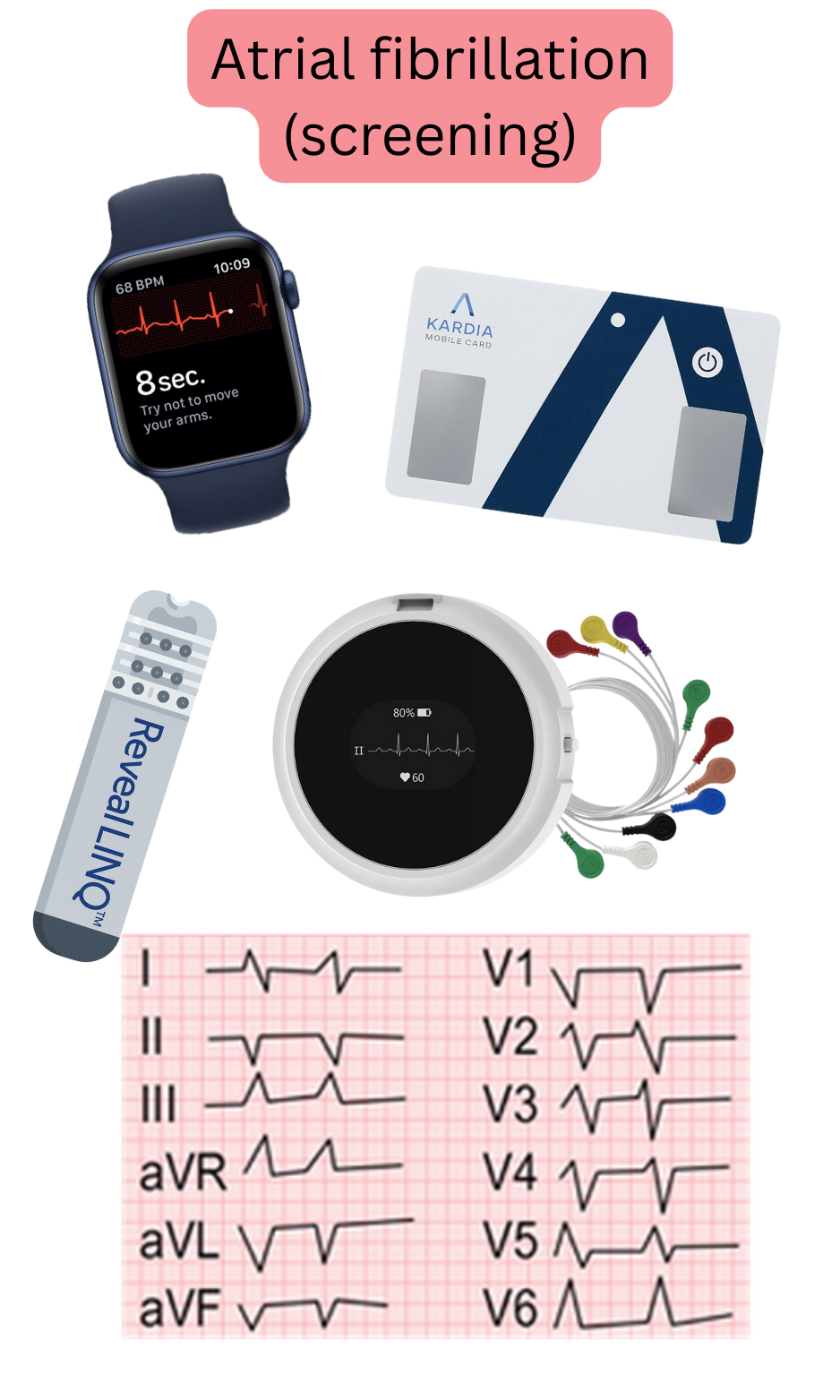 Illustration of atrial fibrillation screening using wearable devices, single-lead ECGs, and ambulatory monitoring systems.
