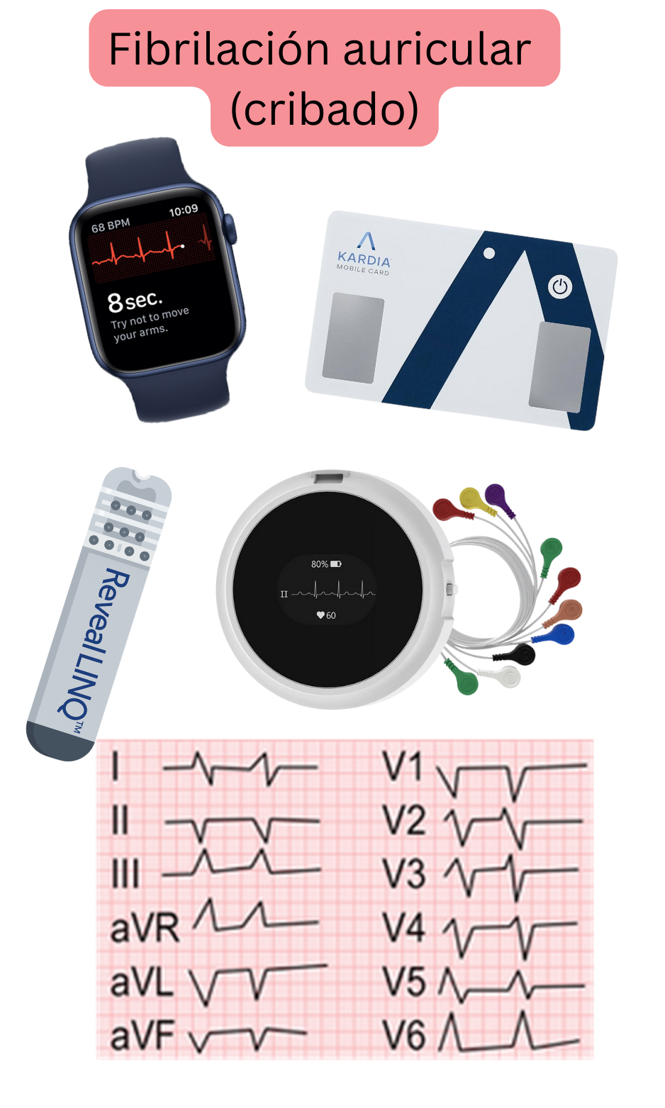 Ilustración del cribado de la fibrilación auricular mediante dispositivos portátiles, ECG de una derivación y sistemas de monitorización ambulatoria.