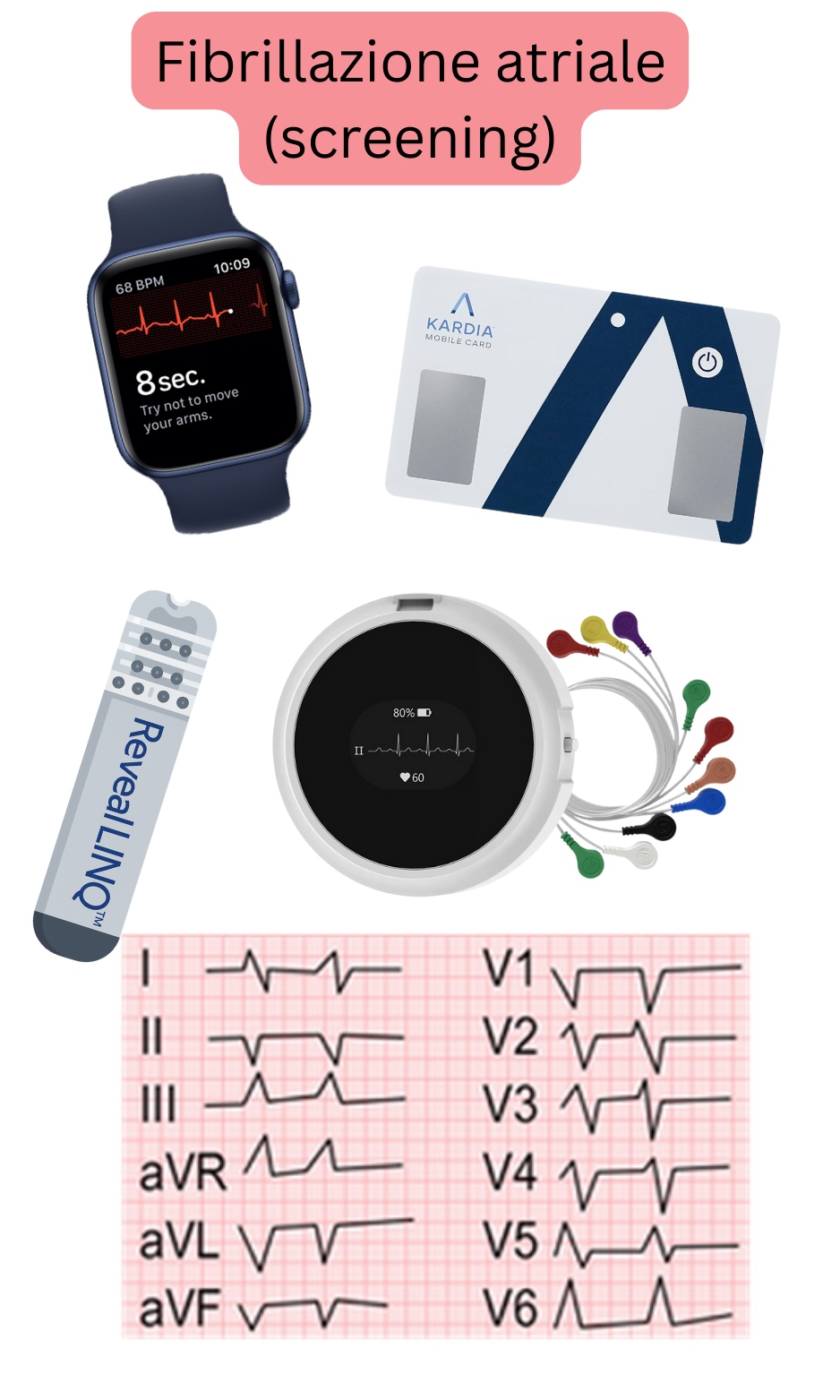 Illustrazione dello screening della fibrillazione atriale mediante dispositivi indossabili, ECG a singola derivazione e sistemi di monitoraggio ambulatoriale.