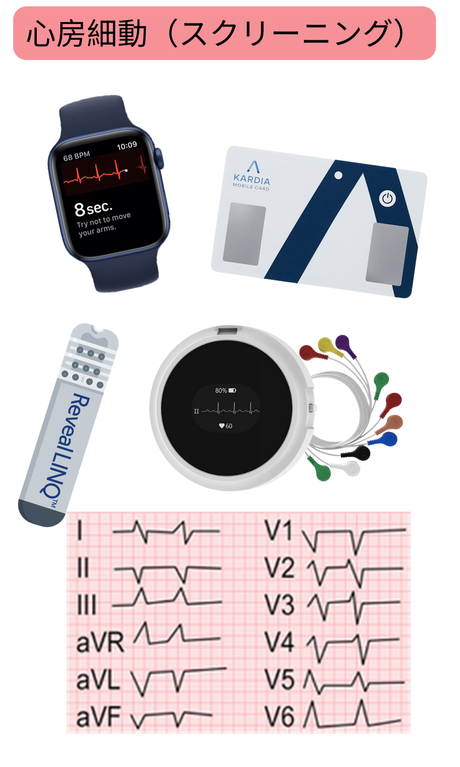ウェアラブル機器、単一誘導心電図、携帯型モニタリングシステムを用いた心房細動スクリーニングの模式図。