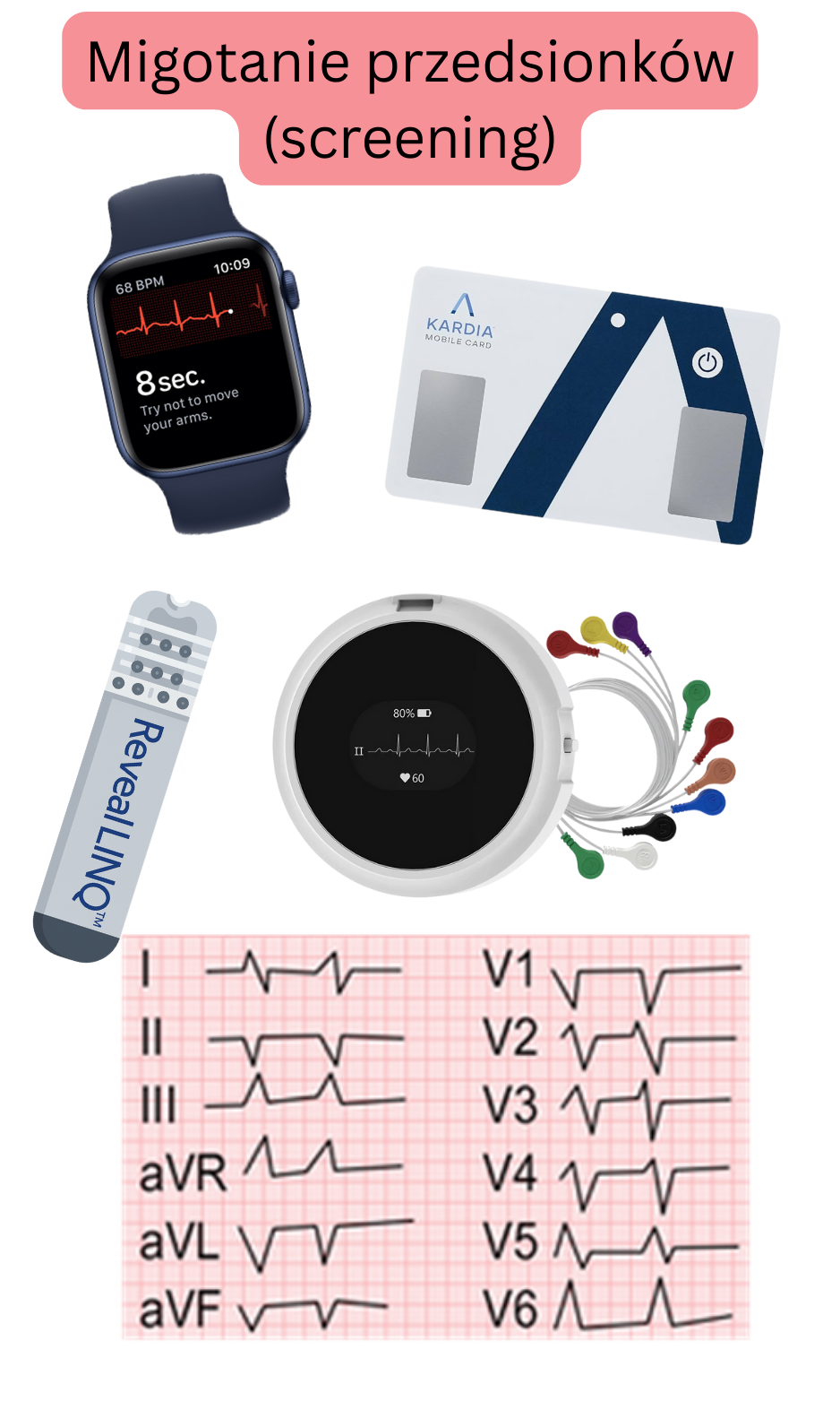 Ilustracja przesiewowego wykrywania migotania przedsionków z użyciem urządzeń noszonych, jednoodprowadzeniowego EKG oraz ambulatoryjnych systemów monitorowania.