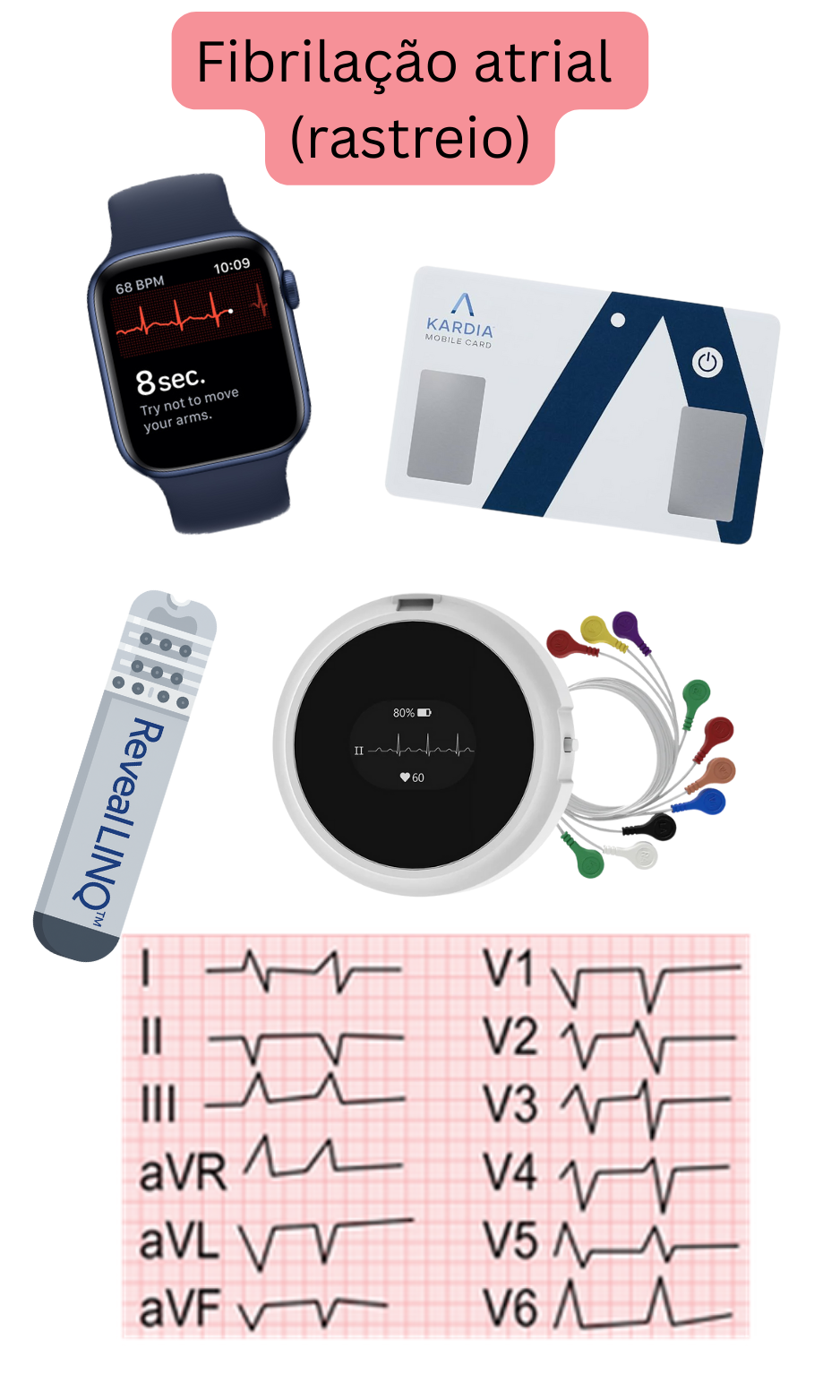 Ilustração do rastreio da fibrilação atrial utilizando dispositivos vestíveis, ECG de uma derivação e sistemas de monitorização ambulatorial.
