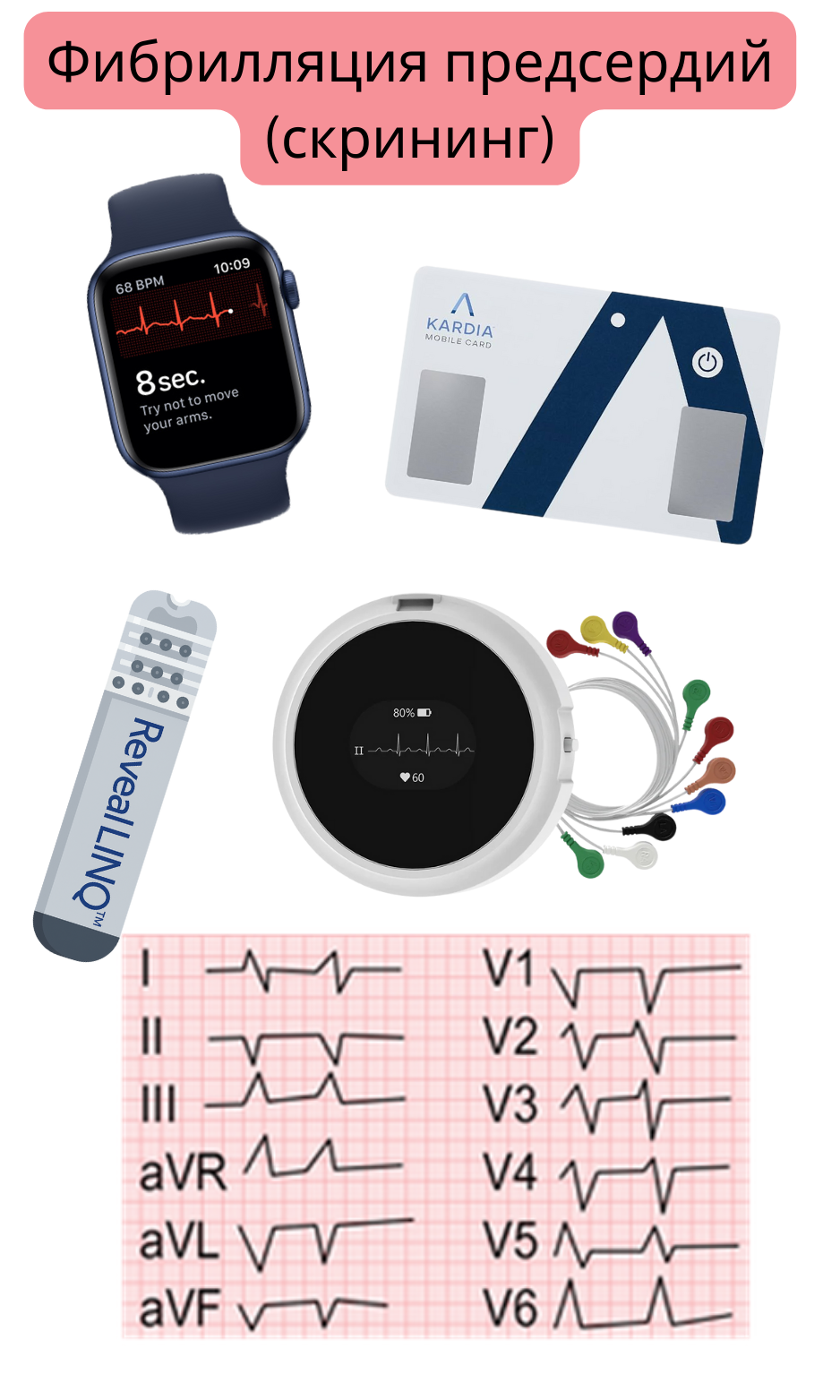 Иллюстрация скрининга фибрилляции предсердий с использованием носимых устройств, одноканальной ЭКГ и амбулаторных систем мониторирования.