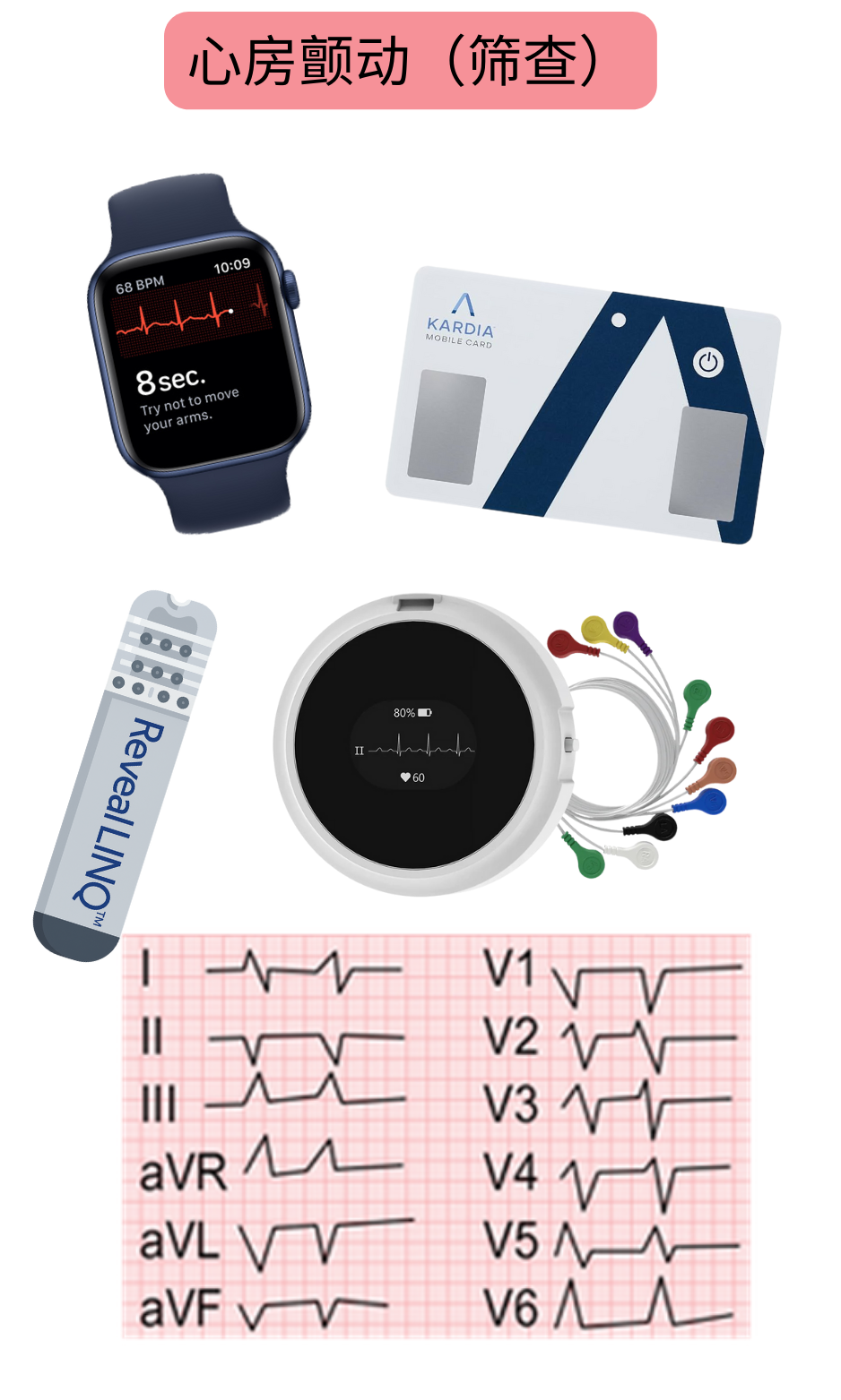 示意图展示利用可穿戴设备、单导联心电图和动态监测系统进行心房颤动筛查。