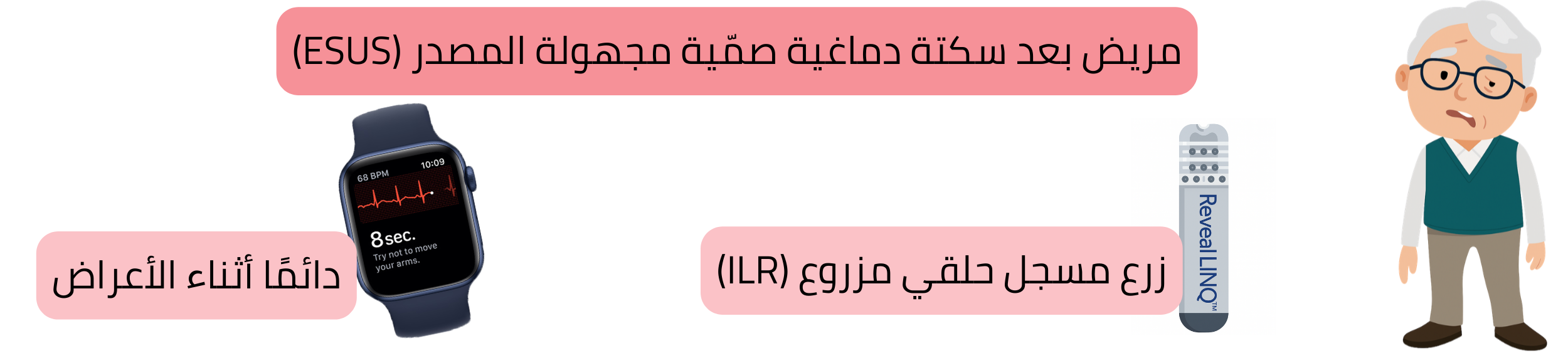 مخطط لكشف الرجفان الأذيني لدى المرضى بعد ESUS باستخدام زرع مسجل نظم قلبي قابل للزرع (ILR) وتسجيل تخطيط القلب أثناء الأعراض.