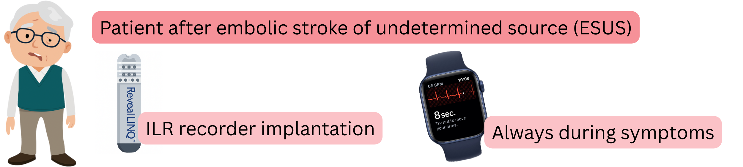 Diagram of atrial fibrillation detection in post-ESUS patients using an implanted ILR recorder and ECG recordings during symptoms.