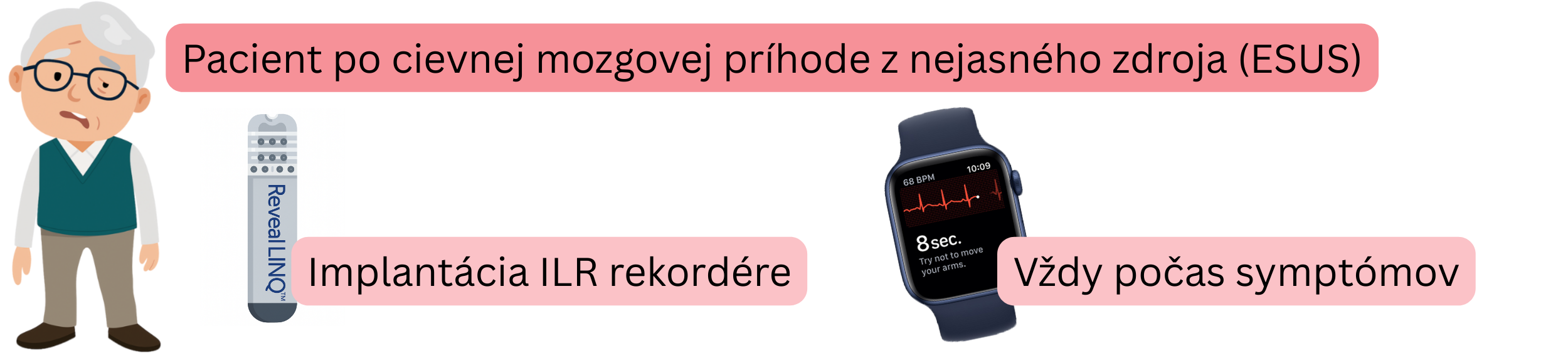 Schéma detekcie fibrilácie predsiení u pacientov po ESUS s implantáciou ILR rekordéra a EKG záznamom počas symptómov.