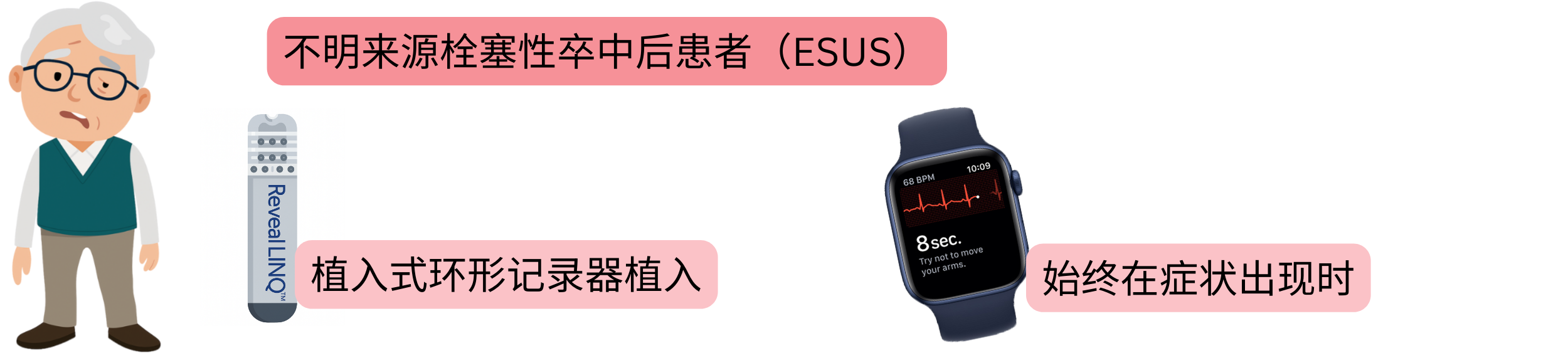 示意图展示ESUS后患者通过植入式心律记录器（ILR）及症状发作时心电图记录进行心房颤动检测。