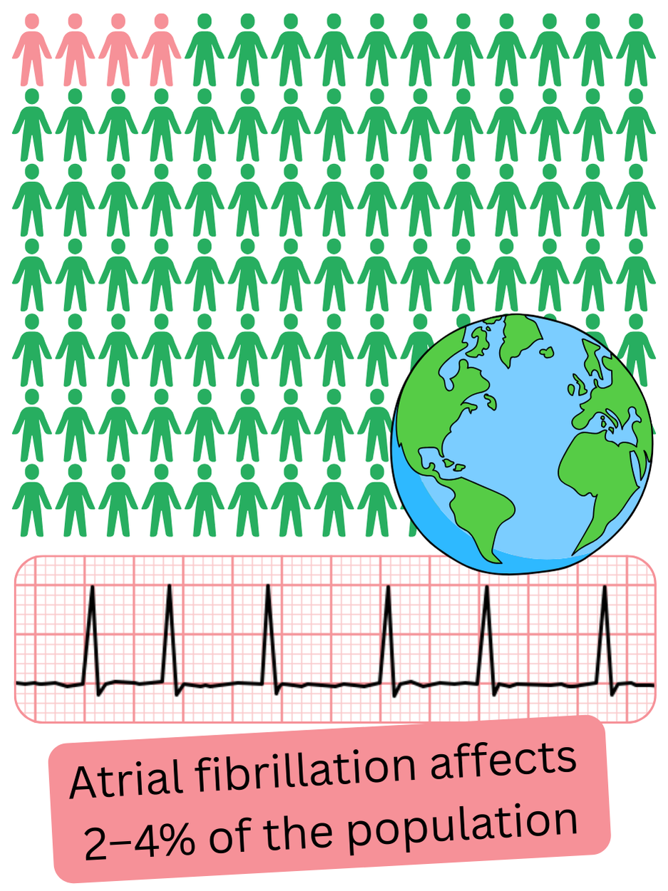 Infographic illustrating the prevalence of atrial fibrillation across individual countries worldwide, expressed as a percentage of the population.