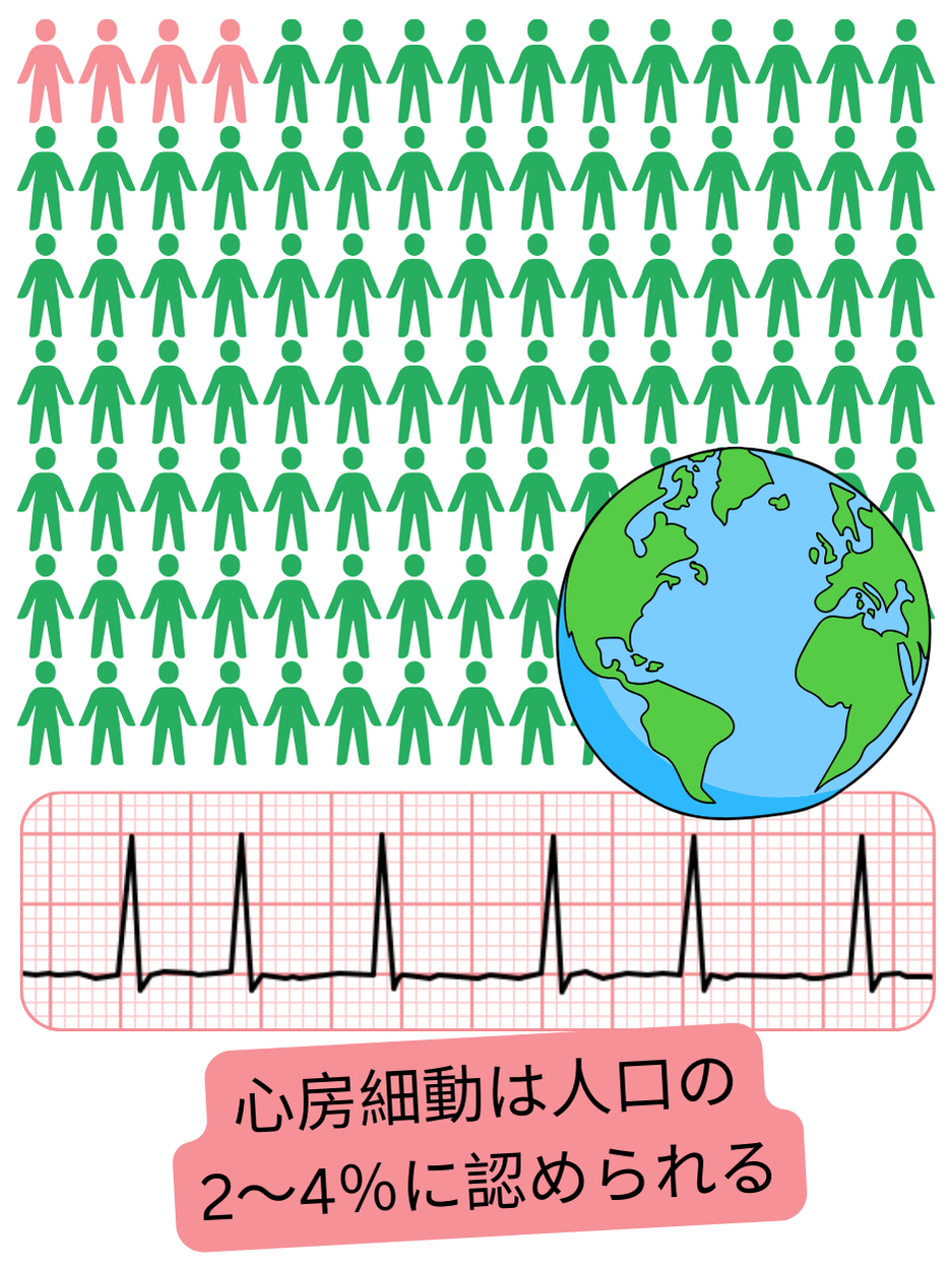 世界各国における心房細動の有病率を人口に対する割合で示したインフォグラフィック。