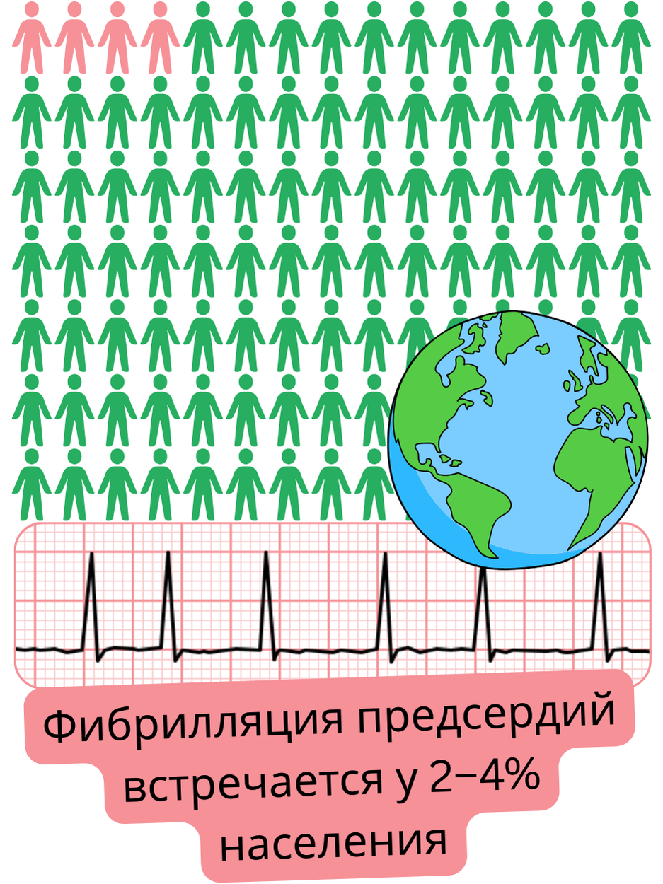 Инфографика, показывающая распространённость фибрилляции предсердий в разных странах мира, выраженную в процентах от численности населения.