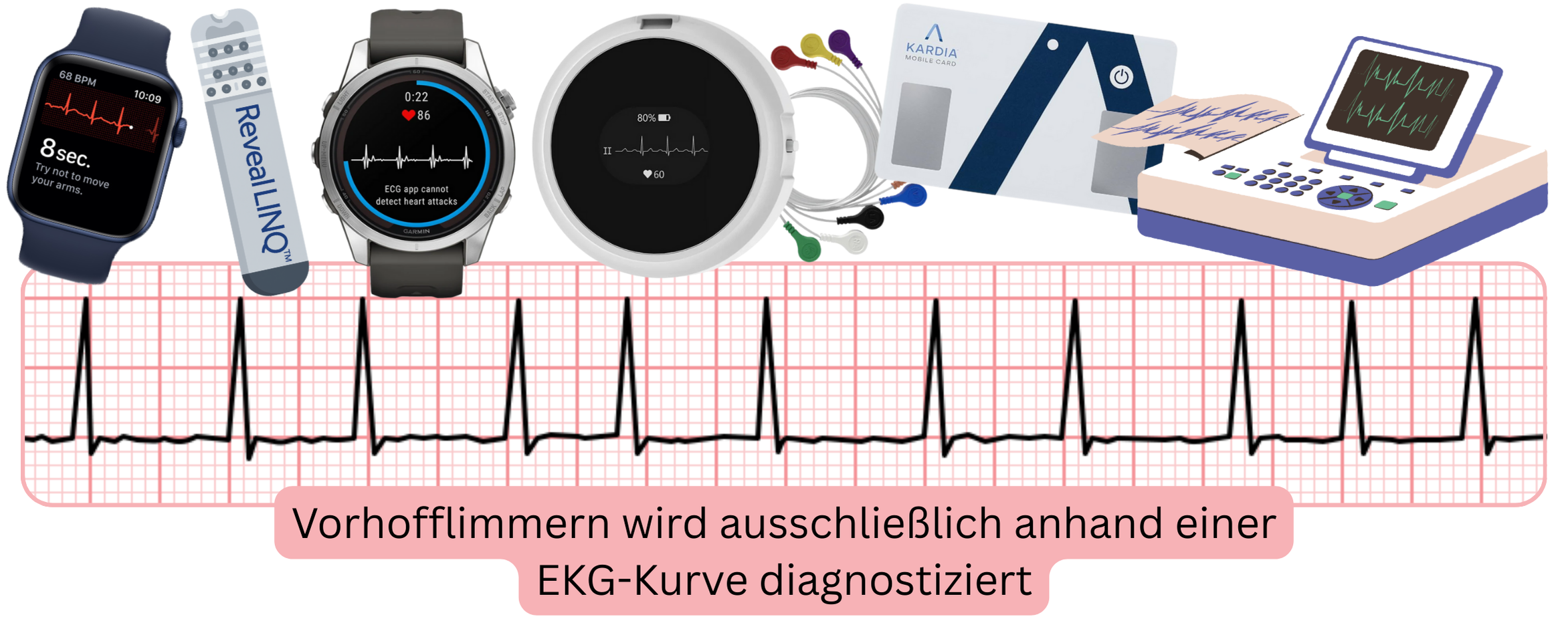 Infografik zur Darstellung der Diagnostik des Vorhofflimmerns anhand von EKG-Aufzeichnungen aus Screening- und Monitoringgeräten.