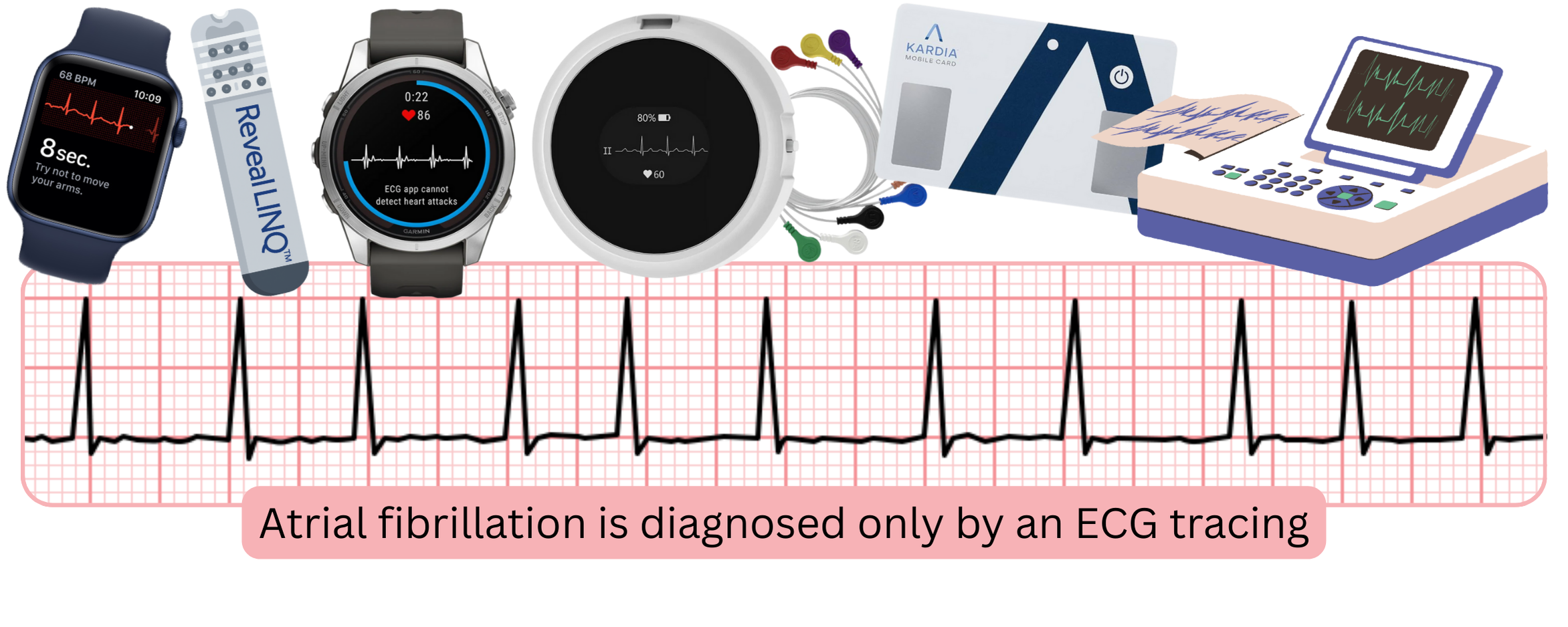 Infographic illustrating the diagnosis of atrial fibrillation using ECG recordings from screening and monitoring devices.