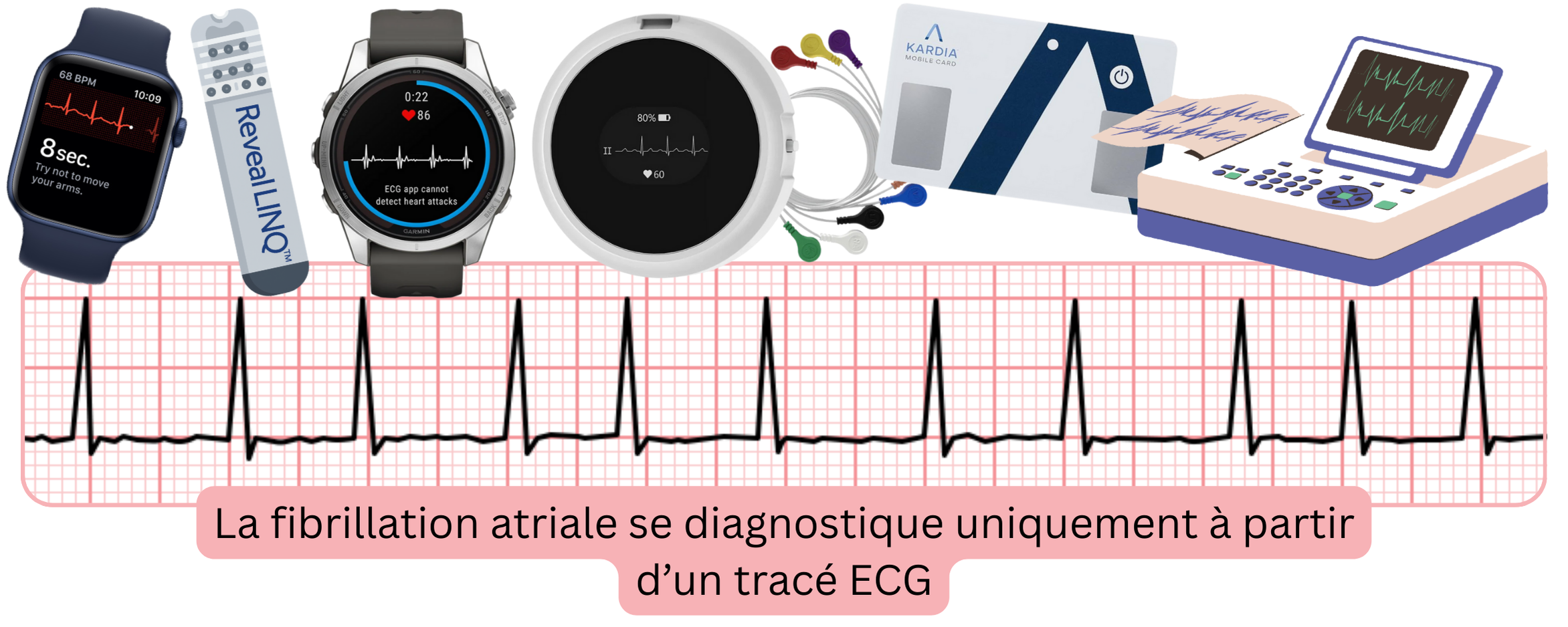 Infographie illustrant le diagnostic de la fibrillation atriale à l’aide d’enregistrements ECG provenant de dispositifs de dépistage et de monitorage.