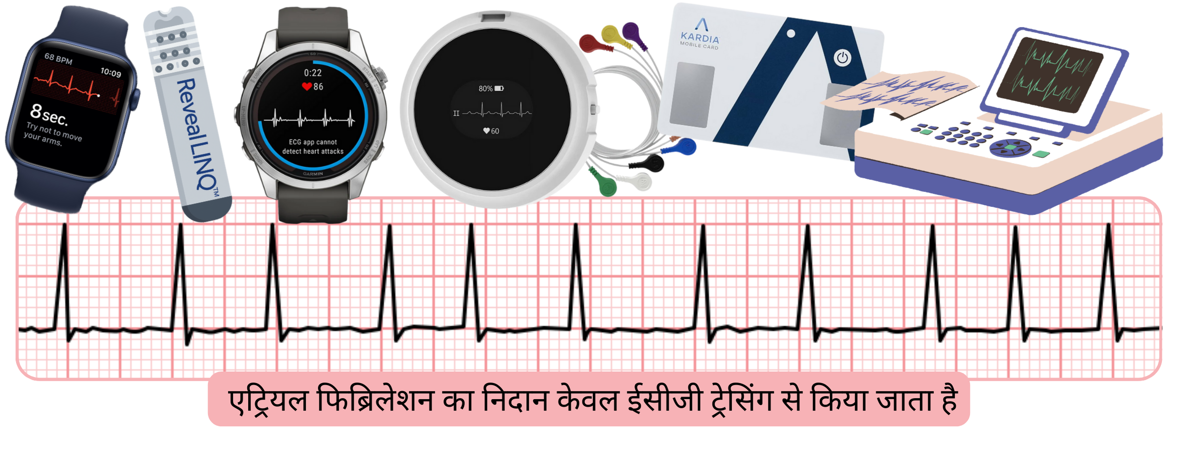 इन्फोग्राफिक जो स्क्रीनिंग और मॉनिटरिंग उपकरणों से प्राप्त ईसीजी रिकॉर्डिंग के माध्यम से एट्रियल फिब्रिलेशन के निदान को दर्शाता है।