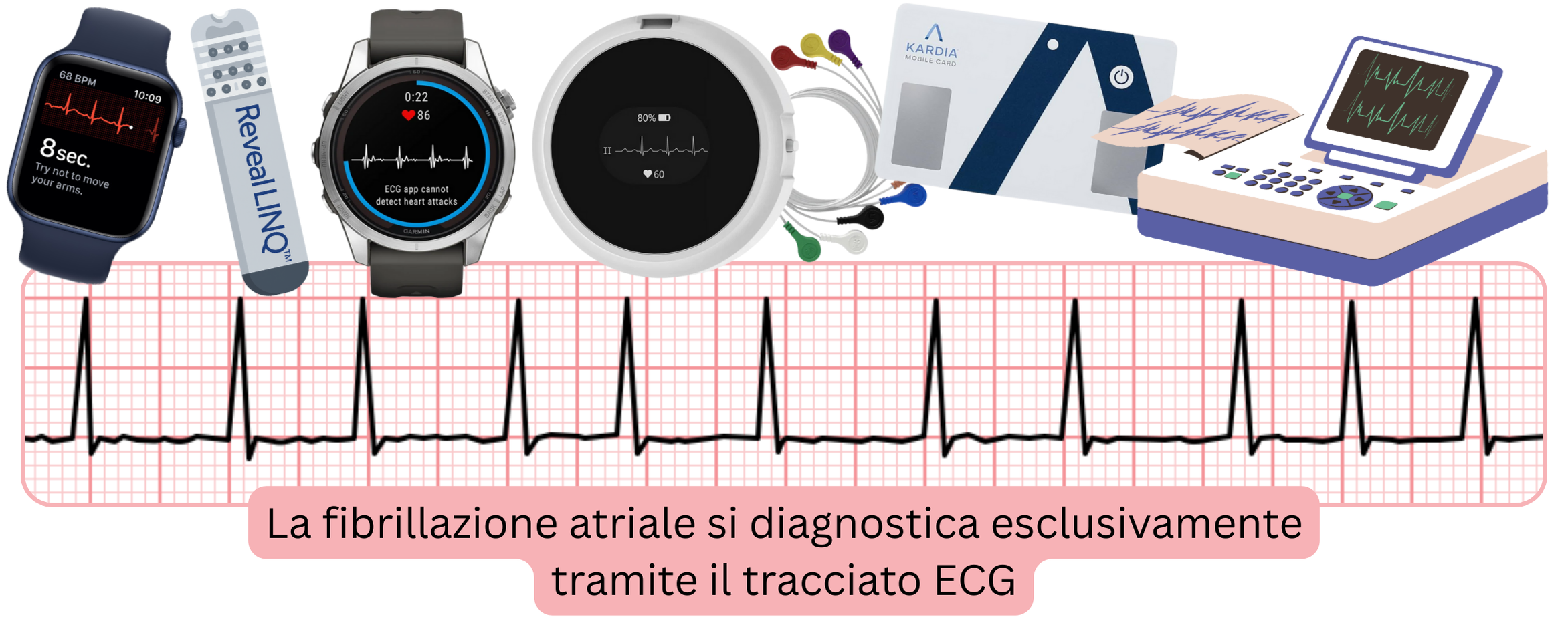 Infografica che illustra la diagnosi della fibrillazione atriale mediante registrazioni ECG provenienti da dispositivi di screening e monitoraggio.