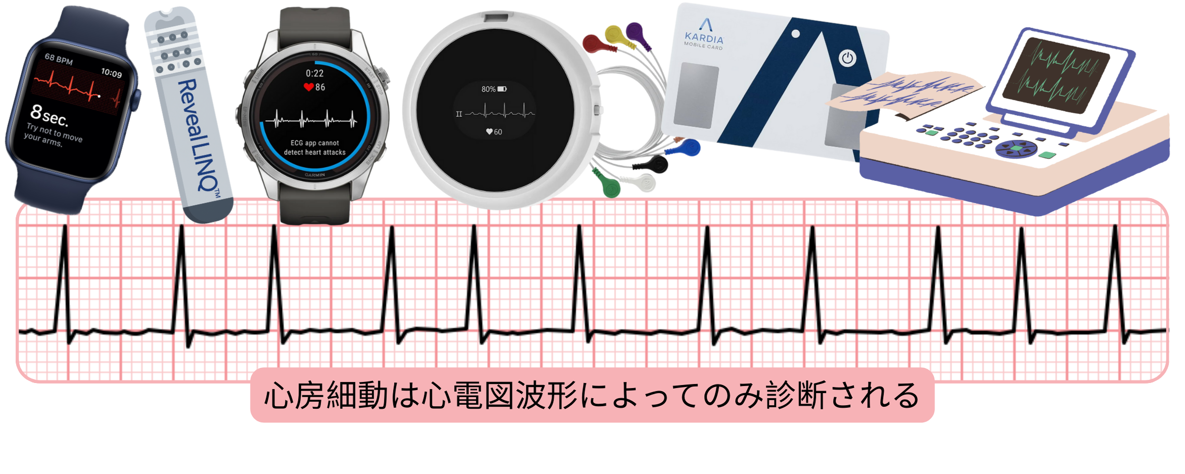 スクリーニングおよびモニタリング機器から得られた心電図記録を用いた心房細動診断を示すインフォグラフィック。