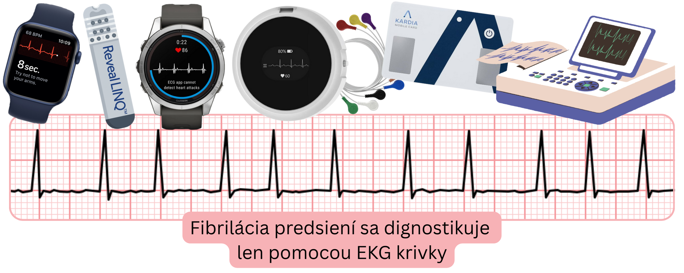 Infografika znázorňujúca diagnostiku fibrilácie predsiení pomocou EKG záznamu zo skríningových a monitorovacích zariadení.