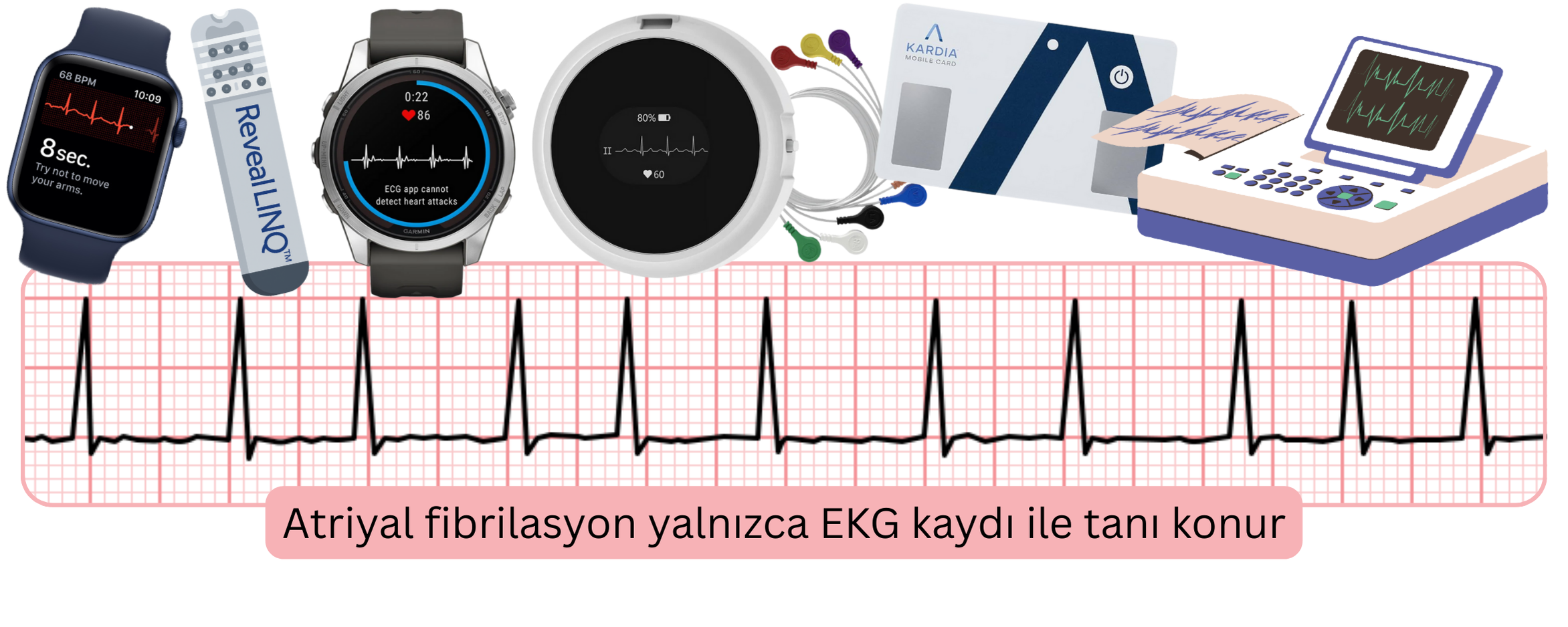 Tarama ve izlem cihazlarından elde edilen EKG kayıtları kullanılarak atriyal fibrilasyon tanısını gösteren infografik.