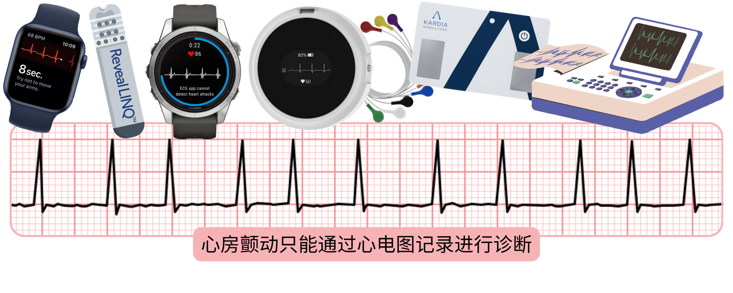 信息图展示通过筛查和监测设备获取的心电图记录进行心房颤动诊断。