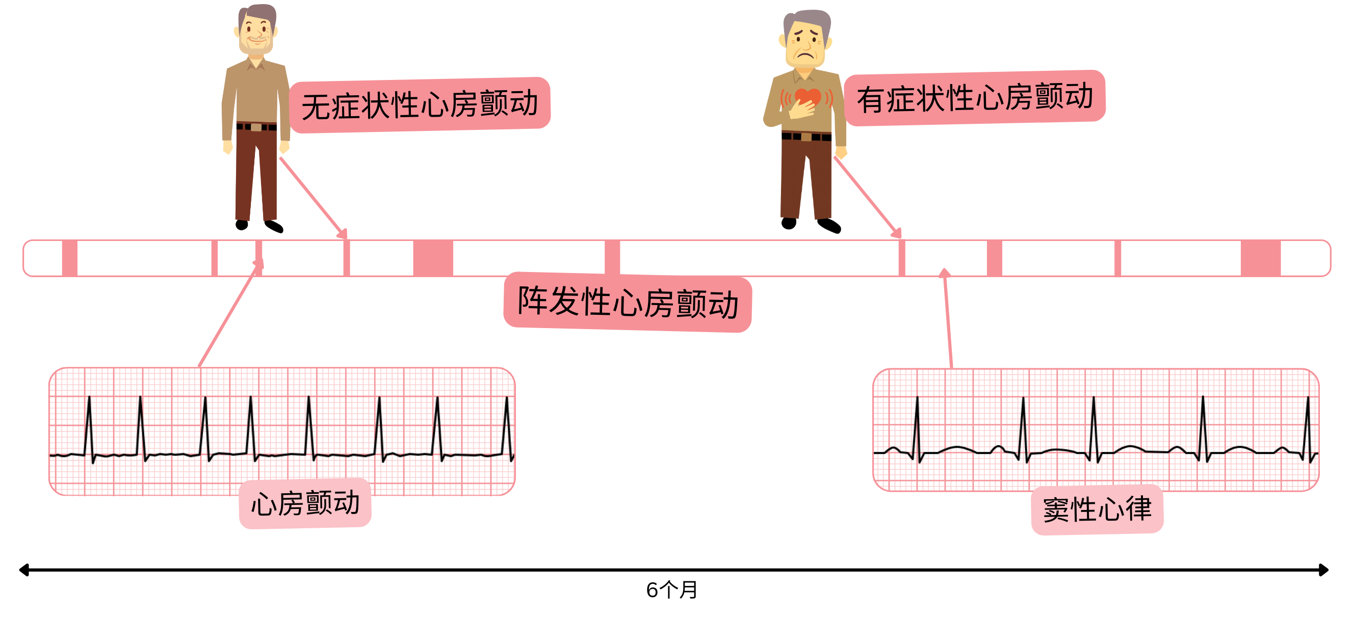 示意图展示阵发性心房颤动中，症状性与无症状患者之间心房颤动发作与窦性心律交替出现的情况。