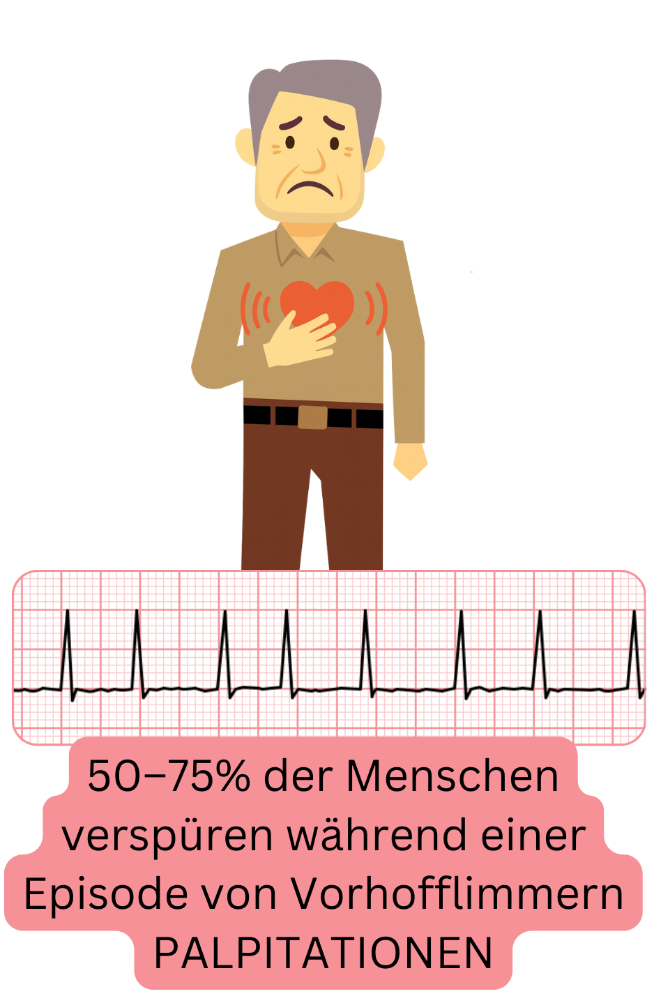 Illustration, die Palpitationen als häufigstes Symptom des Vorhofflimmerns darstellt, vorhanden bei etwa 50–75 % der Patienten während einer Episode.