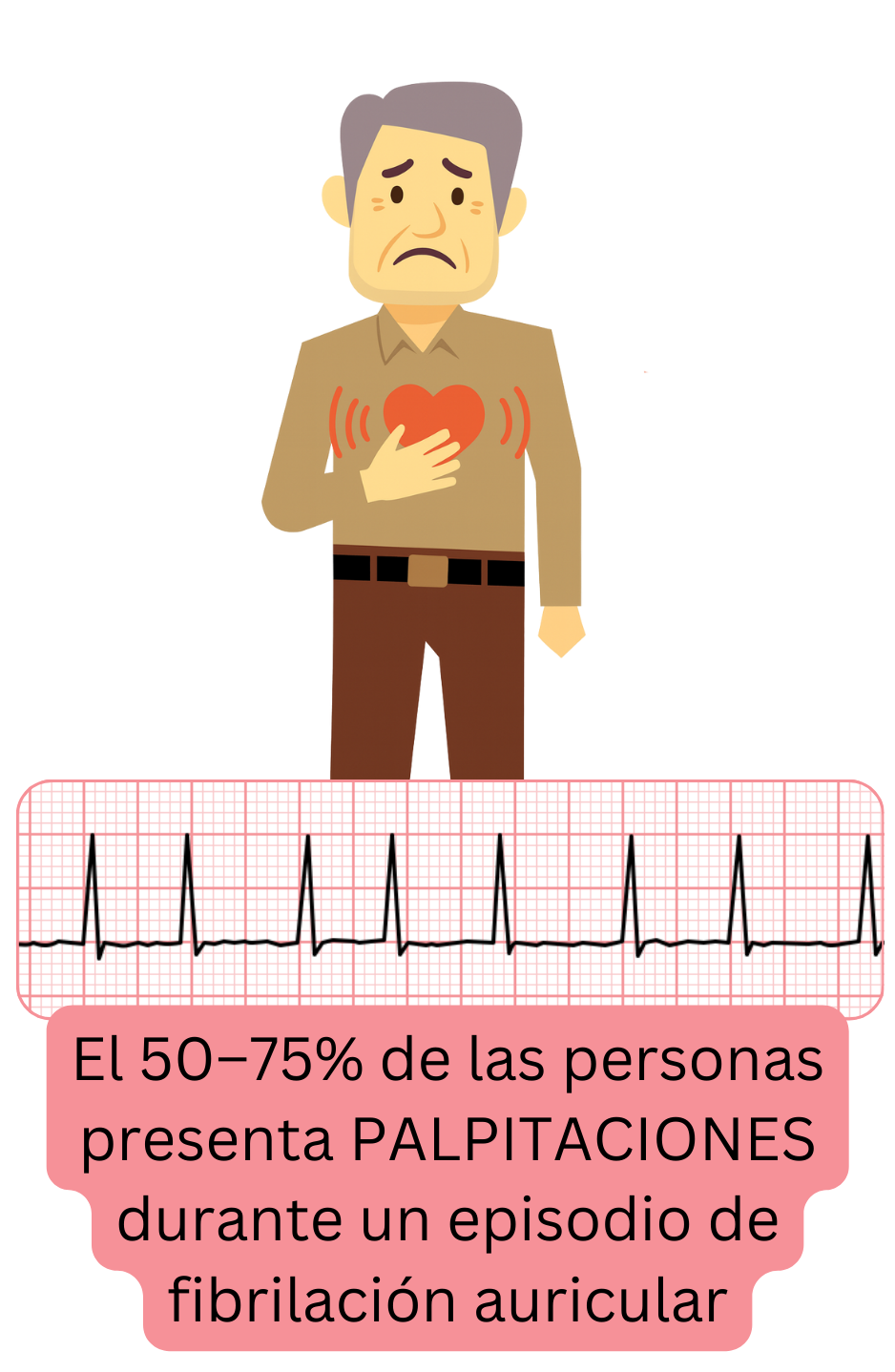 Ilustración que muestra las palpitaciones como el síntoma más frecuente de la fibrilación auricular, presente en aproximadamente el 50–75% de los pacientes durante el episodio.