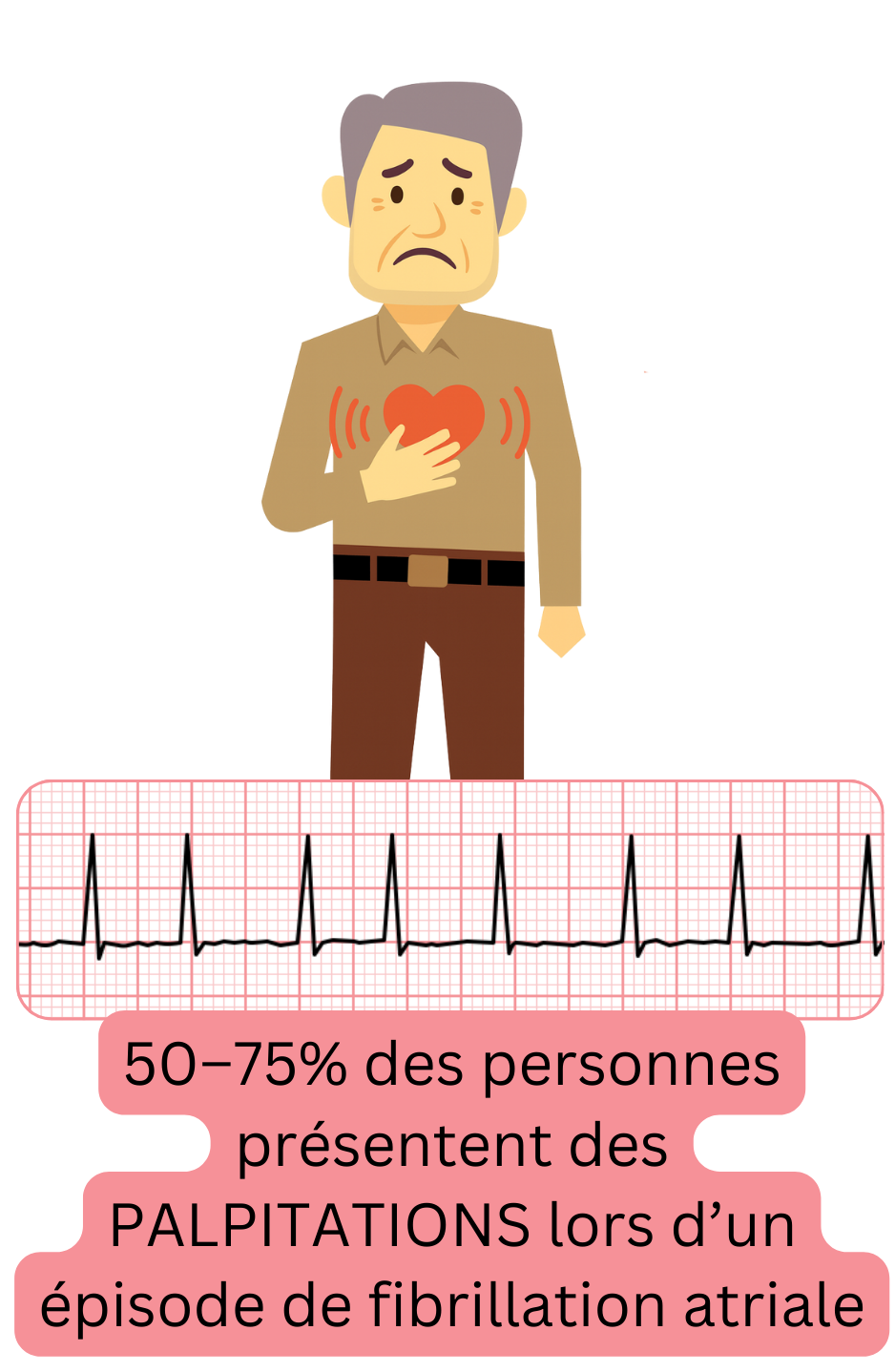 Illustration montrant les palpitations comme le symptôme le plus fréquent de la fibrillation atriale, présent chez environ 50–75 % des patients lors de l’épisode.