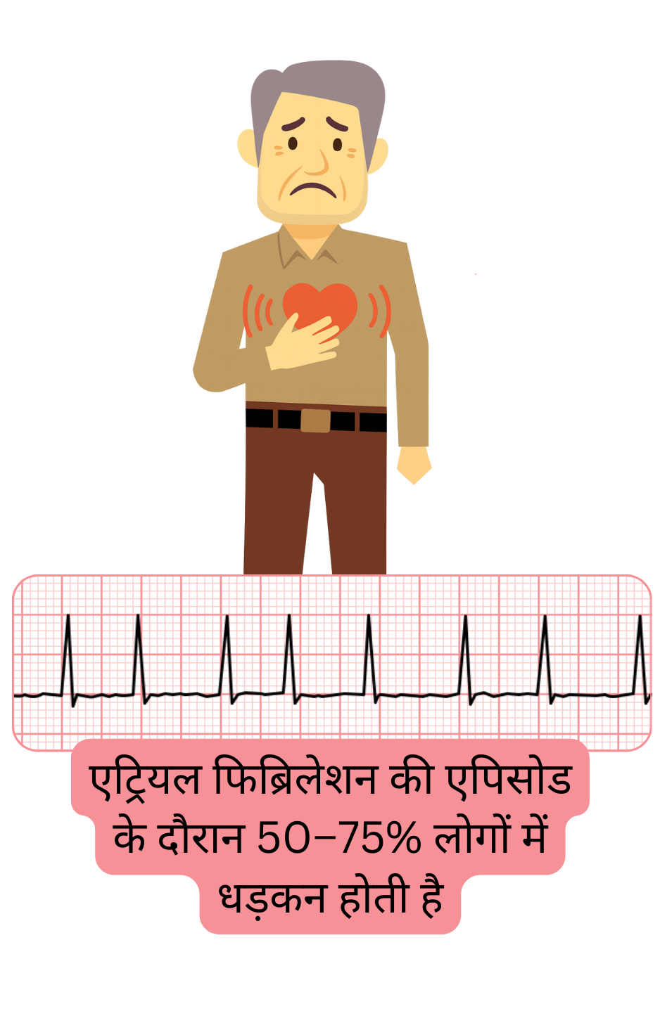 चित्रण जो धड़कन महसूस होना (पाल्पिटेशन) को एट्रियल फिब्रिलेशन का सबसे सामान्य लक्षण दर्शाता है, जो एपिसोड के दौरान लगभग 50–75% रोगियों में पाया जाता है।