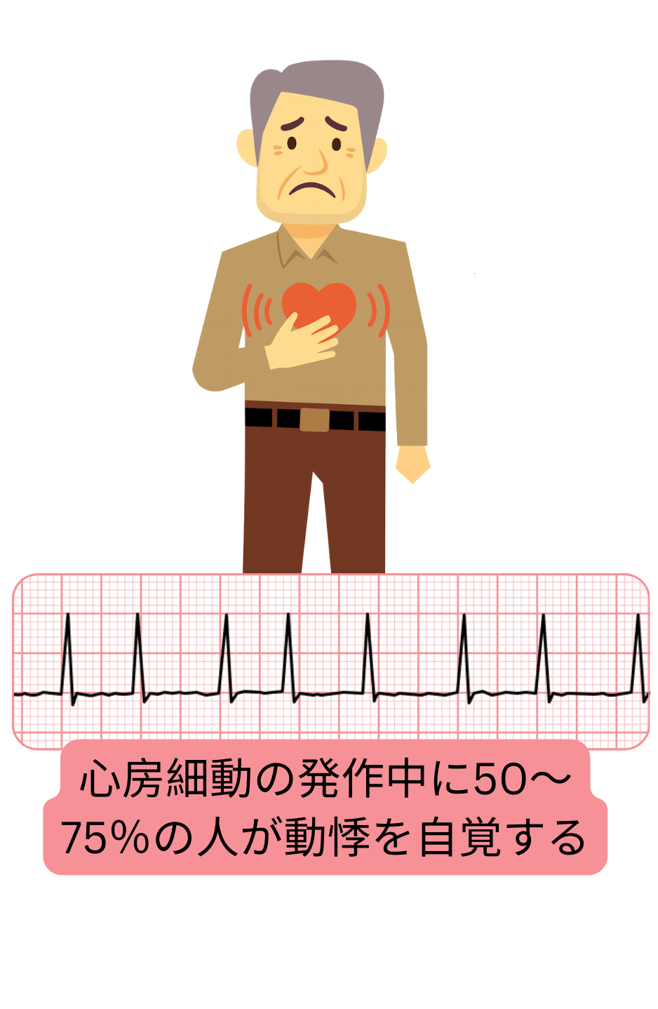 心房細動の最も一般的な症状として、発作中に約50～75％の患者で認められる動悸を示す図。