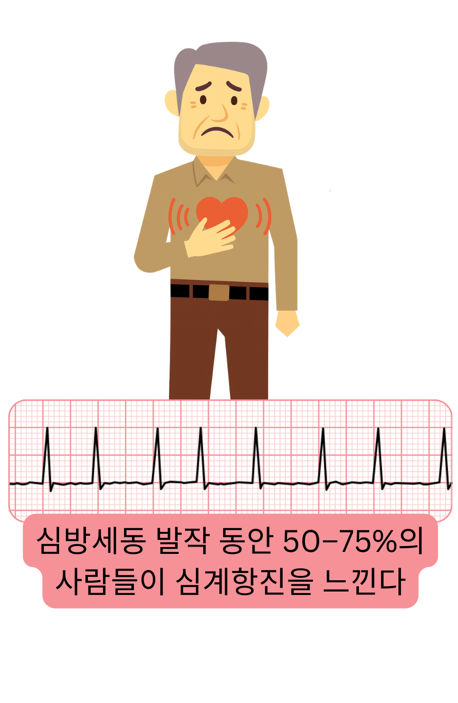 심방세동의 가장 흔한 증상으로, 발작 동안 약 50–75%의 환자에서 나타나는 심계항진을 보여주는 그림.
