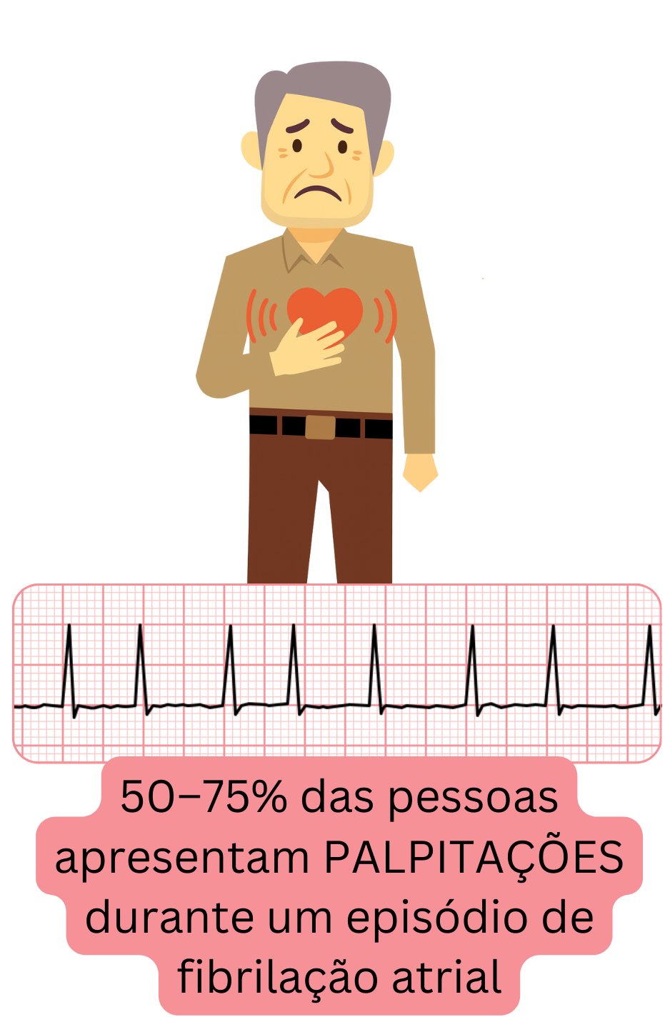 Ilustração que mostra as palpitações como o sintoma mais comum da fibrilação atrial, presente em aproximadamente 50–75% dos pacientes durante o episódio.