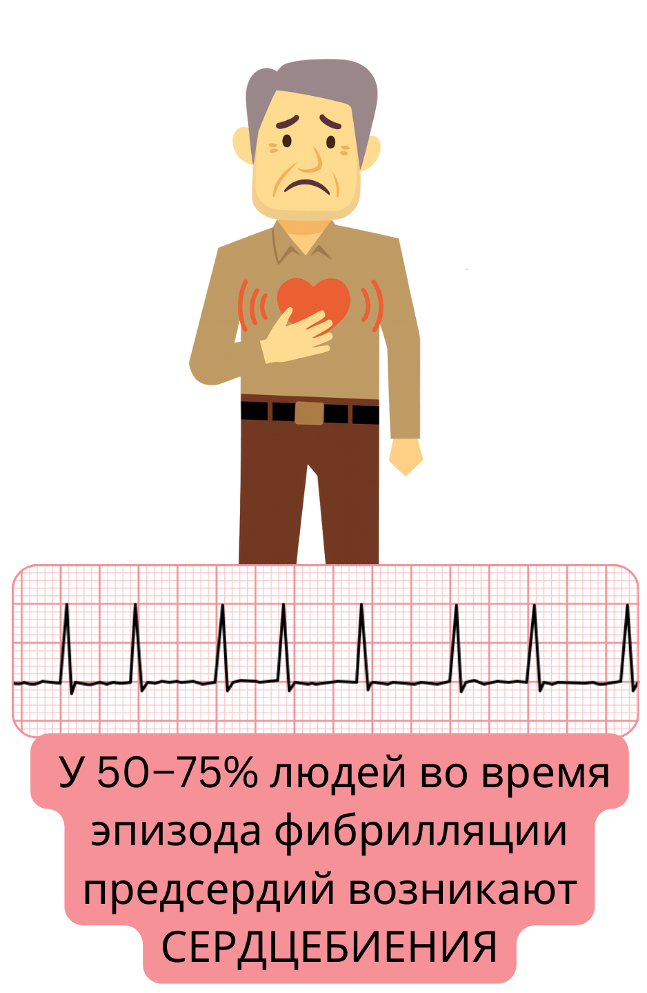 Иллюстрация, показывающая сердцебиение как наиболее частый симптом фибрилляции предсердий, отмечаемый примерно у 50–75 % пациентов во время эпизода.
