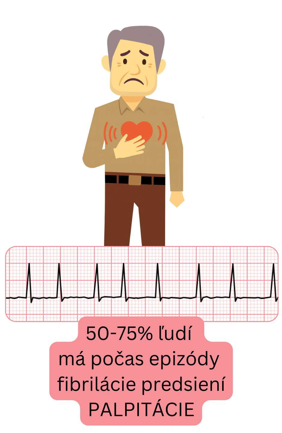 Ilustrácia zobrazujúca palpitácie ako najčastejší symptóm fibrilácie predsiení, prítomný u približne 50–75 % pacientov počas epizódy.