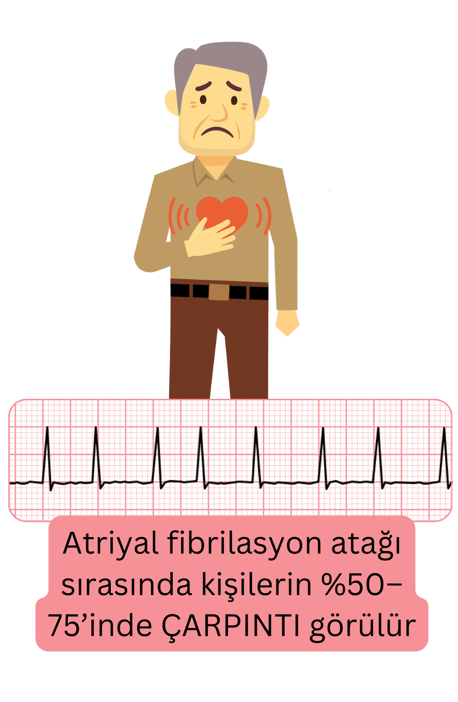 Atriyal fibrilasyonun en sık görülen semptomu olan çarpıntıyı, atak sırasında hastaların yaklaşık %50–75’inde görüldüğünü gösteren illüstrasyon.