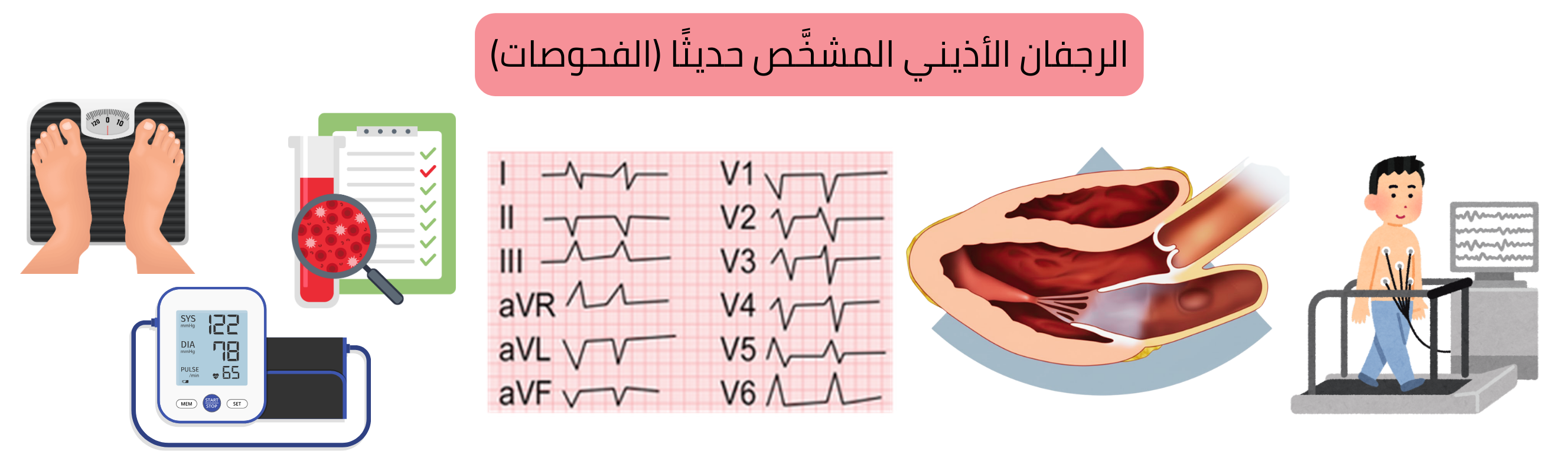 إنفوجرافيك يوضح الفحوصات الأساسية عند تشخيص الرجفان الأذيني حديثًا، بما في ذلك تخطيط القلب، الفحوصات المخبرية، تخطيط صدى القلب واختبار الجهد.