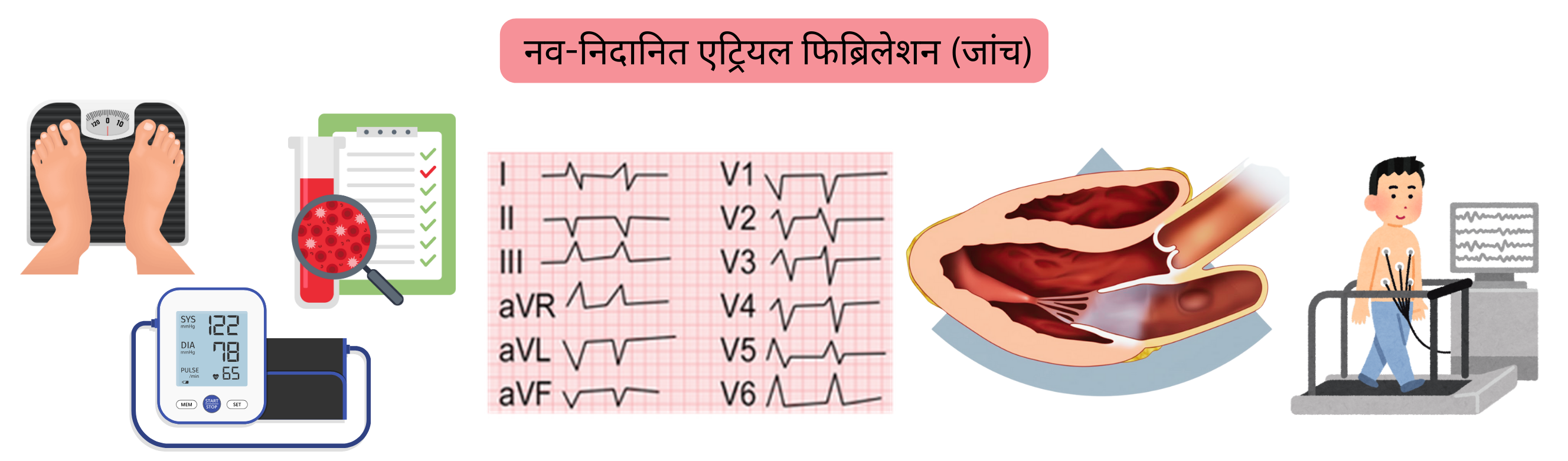 इन्फोग्राफिक जो नव-निदानित एट्रियल फिब्रिलेशन में मूलभूत जांचों को दर्शाता है, जिसमें ईसीजी, प्रयोगशाला परीक्षण, इकोकार्डियोग्राफी और व्यायाम परीक्षण शामिल हैं।